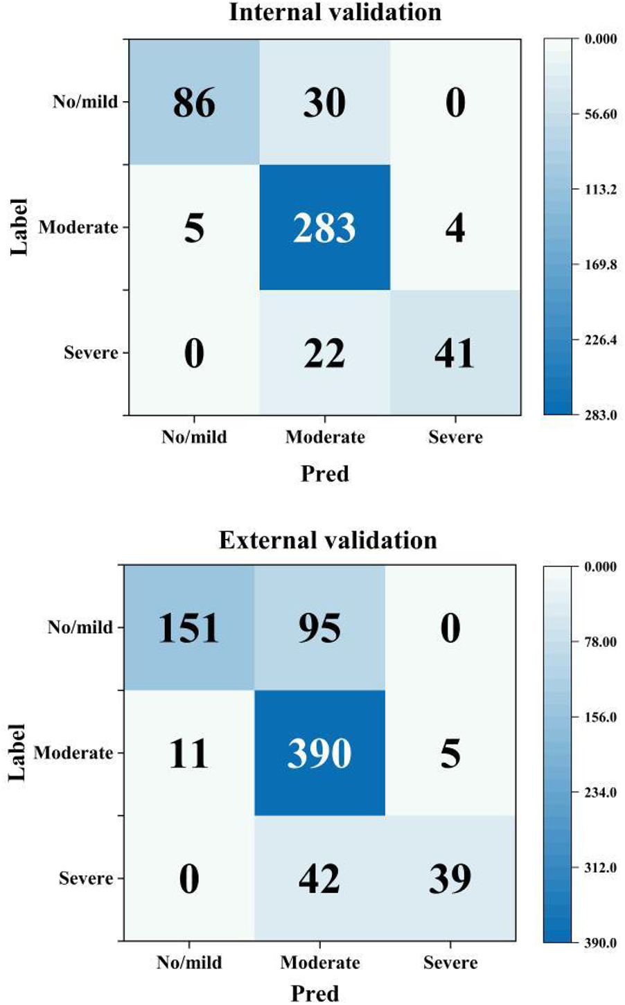 Confusion matrices for internal and external validation. The internal validation matrix shows true labels versus predictions with counts: No/mild (86/30/0), Moderate (5/283/4), Severe (0/22/41). The external validation matrix shows counts: No/mild (151/95/0), Moderate (11/390/5), Severe (0/42/39). A blue gradient indicates frequency.
