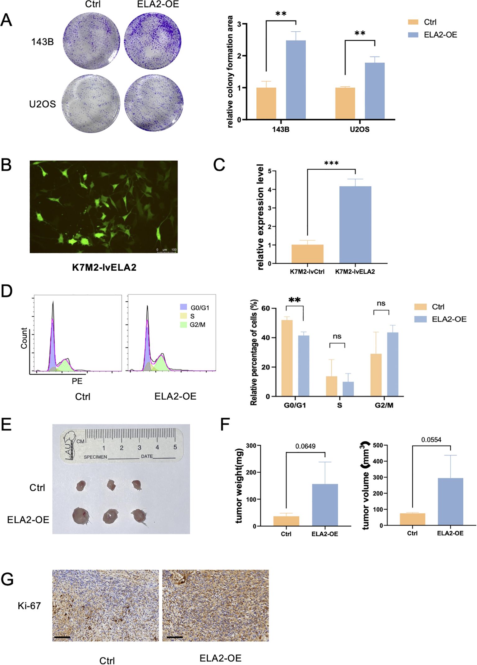 Composite image showing various experimental results: A) Colony formation assay images and a bar graph comparing “Ctrl” and “ELA2-OE” groups for 143B and U2OS cell lines with significant differences marked. B) Fluorescent microscopy image of K7M2-lvELA2 cells with green fluorescence. C) Bar graph showing relative expression levels of K7M2-lvCtrl and K7M2-lvELA2 with a significant difference. D) Flow cytometry histograms and bar graph comparing cell cycle phases between “Ctrl” and “ELA2-OE”. E) Image of tumor samples with a ruler for scale, comparing “Ctrl” and “ELA2-OE”. F) Bar graphs comparing tumor weight and volume between “Ctrl” and “ELA2-OE”. G) Ki-67 staining of tissues from “Ctrl” and “ELA2-OE” groups, showing differences in cell proliferation.