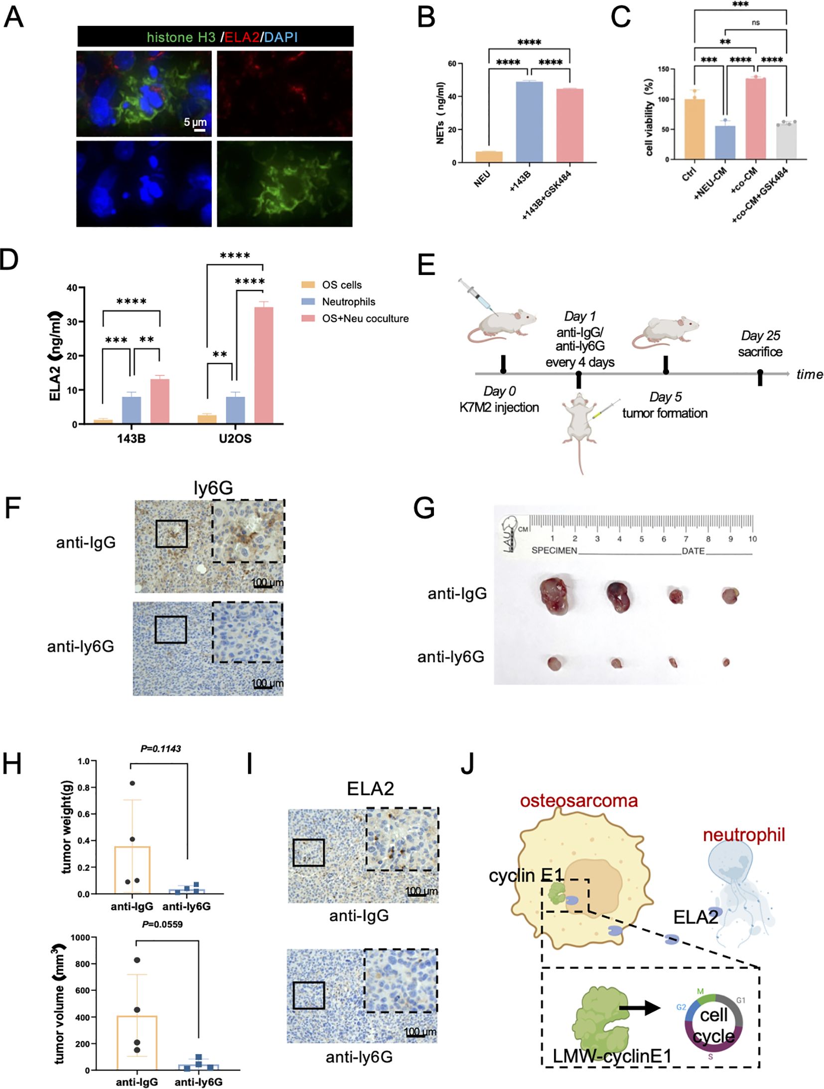 (A) Immunofluorescence images showing histone H3, ELA2, and DAPI in cells. (B) Bar graph of NETs production in neutrophils and cancer cells with statistical significance indicated. (C) Bar chart of cell viability under different culture conditions. (D) ELA2 production in OS cells and neutrophils with indicated significance. (E) Diagram of an experimental timeline involving K7M2 injection and treatments in mice. (F) Tumor tissue stained for anti-IgG and anti-ly6G. (G) Image of tumors next to a ruler for size comparison. (H) Graphs showing tumor weight and volume with P-value annotations. (I) Images of ELA2 expression stained with anti-IgG and anti-ly6G. (J) Diagram depicting interactions between osteosarcoma cells and neutrophils involving cyclin E1 and LMW-cyclinE1 in the cell cycle.