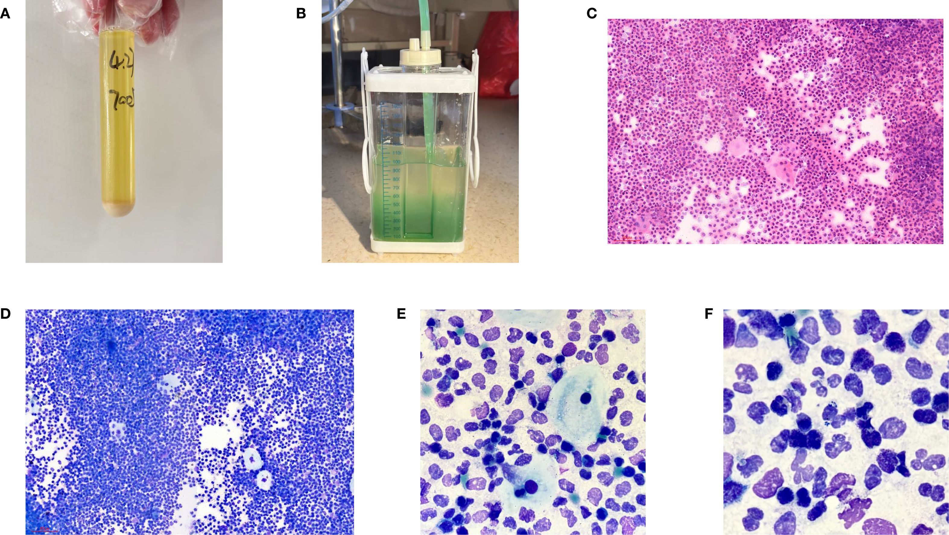 A series of six images labeled A to F. A shows a yellow liquid in a transparent test tube marked with numbers, held by gloved hands. B depicts a container with a green liquid and measurement markings. C is a microscopic view of cells stained in pink and purple. D displays a similar microscopic image with blue-stained cells. E focuses on blue-stained cells with distinct nuclei. F offers a close-up of densely packed blue-stained cells.
