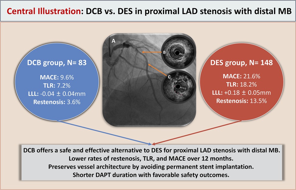 Comparison of drug-coated balloon (DCB) versus drug-eluting stent (DES) for proximal LAD stenosis with distal MB. DCB group (83 patients) shows lower MACE (9.6%), TLR (7.2%), and restenosis (3.6%) rates compared to DES group (148 patients) with MACE (21.6%), TLR (18.2%), and restenosis (13.5%). DCB preserves vessel architecture and allows shorter DAPT duration. Central image illustrates angiography with two circular close-up views marked B and C.