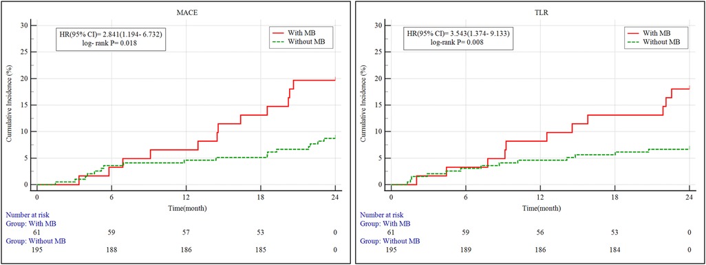 Two graphs, labeled MACE and TLR, show cumulative incidence over time in months. Each graph compares two groups: \