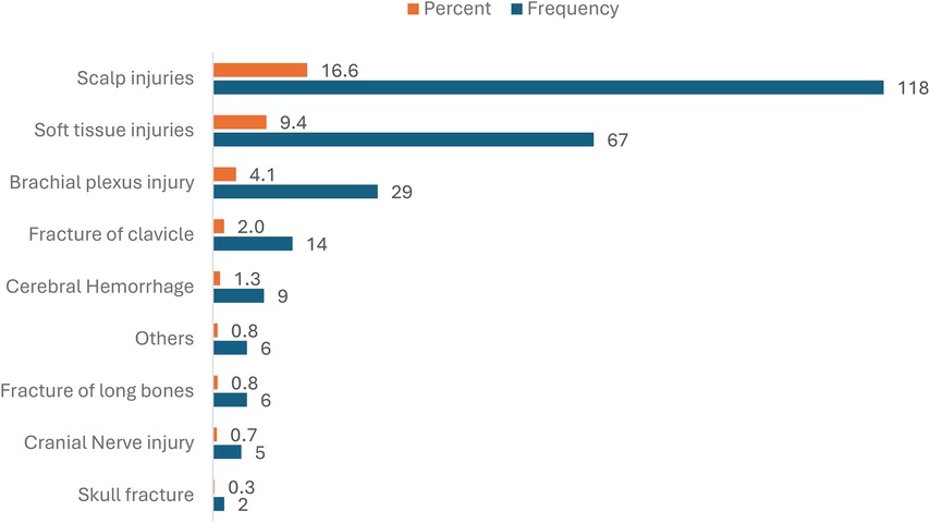 Bar chart titled \