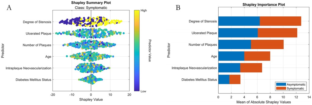 Panel A displays a Shapley Summary Plot for symptomatic predictions, illustrating predictor influence using colored dots representing predictor values. Panel B shows a Shapley Importance Plot with mean absolute Shapley values for asymptomatic and symptomatic classes across predictors, using blue and orange bars. Predictors include Degree of Stenosis, Ulcerated Plaque, Number of Plaques, Age, Intraplaque Neovascularization, and Diabetes Mellitus Status.