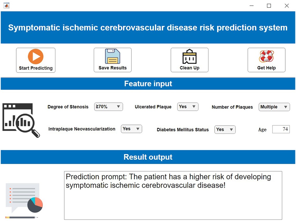 Graphical user interface of a symptomatic ischemic cerebrovascular disease risk prediction system. It includes buttons for starting prediction, saving results, cleaning up, and getting help. Feature input section shows parameters like degree of stenosis (greater than or equal to seventy percent), presence of ulcerated plaque, multiple plaques, intraplaque neovascularization, diabetes mellitus status, and age (seventy-four). The result output states a higher risk of developing symptomatic ischemic cerebrovascular disease.