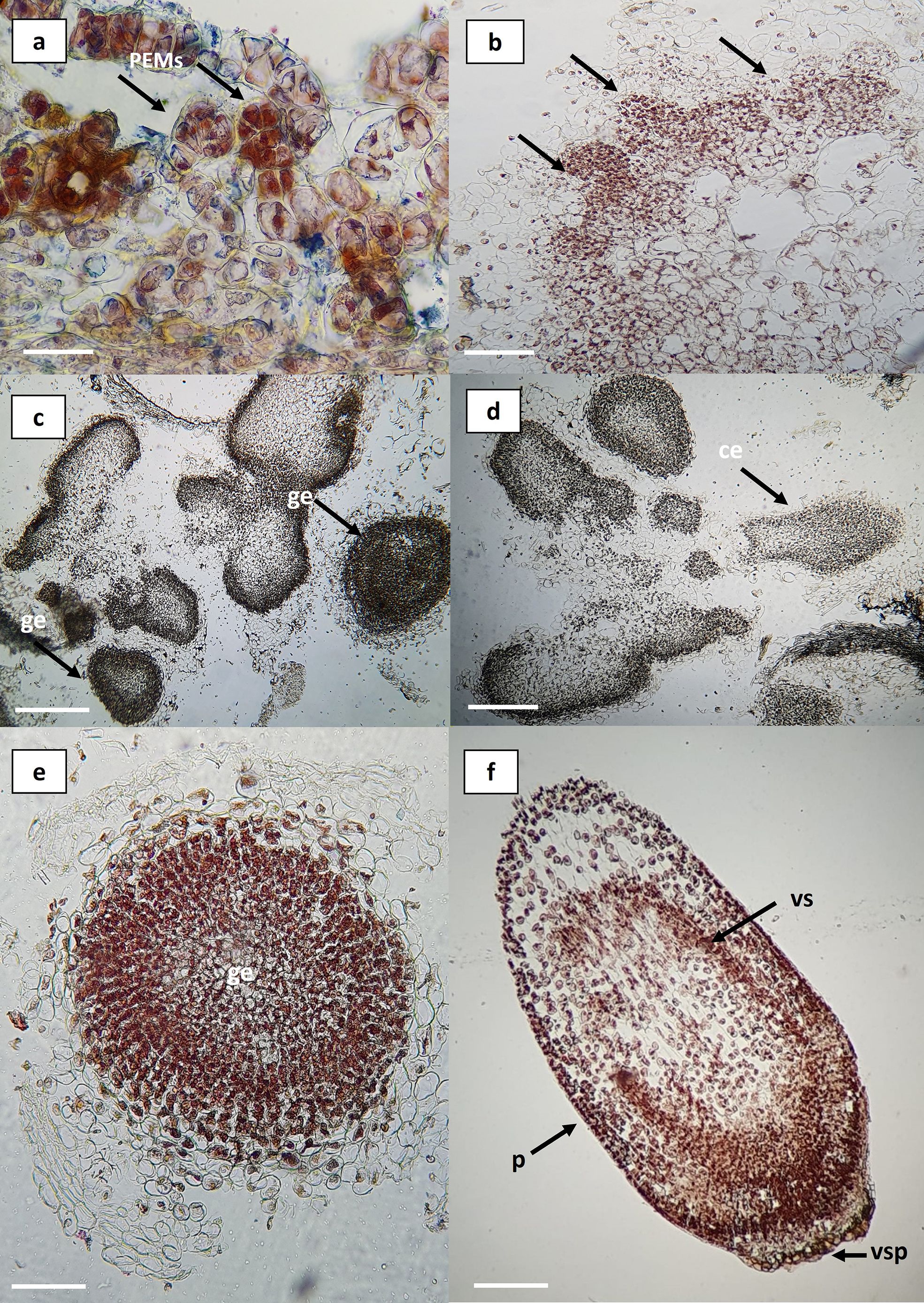 Microscopic images showing various stages of plant embryo development. Panel (a) displays PEMs with labeled arrows. Panel (b) shows an early embryo stage with multiple clusters. Panels (c) and (d) depict globular and coiled embryos marked with “ge” and “ce.” Panel (e) highlights a globular embryo with central labeling. Panel (f) illustrates a mature embryo with parts labeled “vs” and “vsp.” Scale bars present in each panel for size reference.