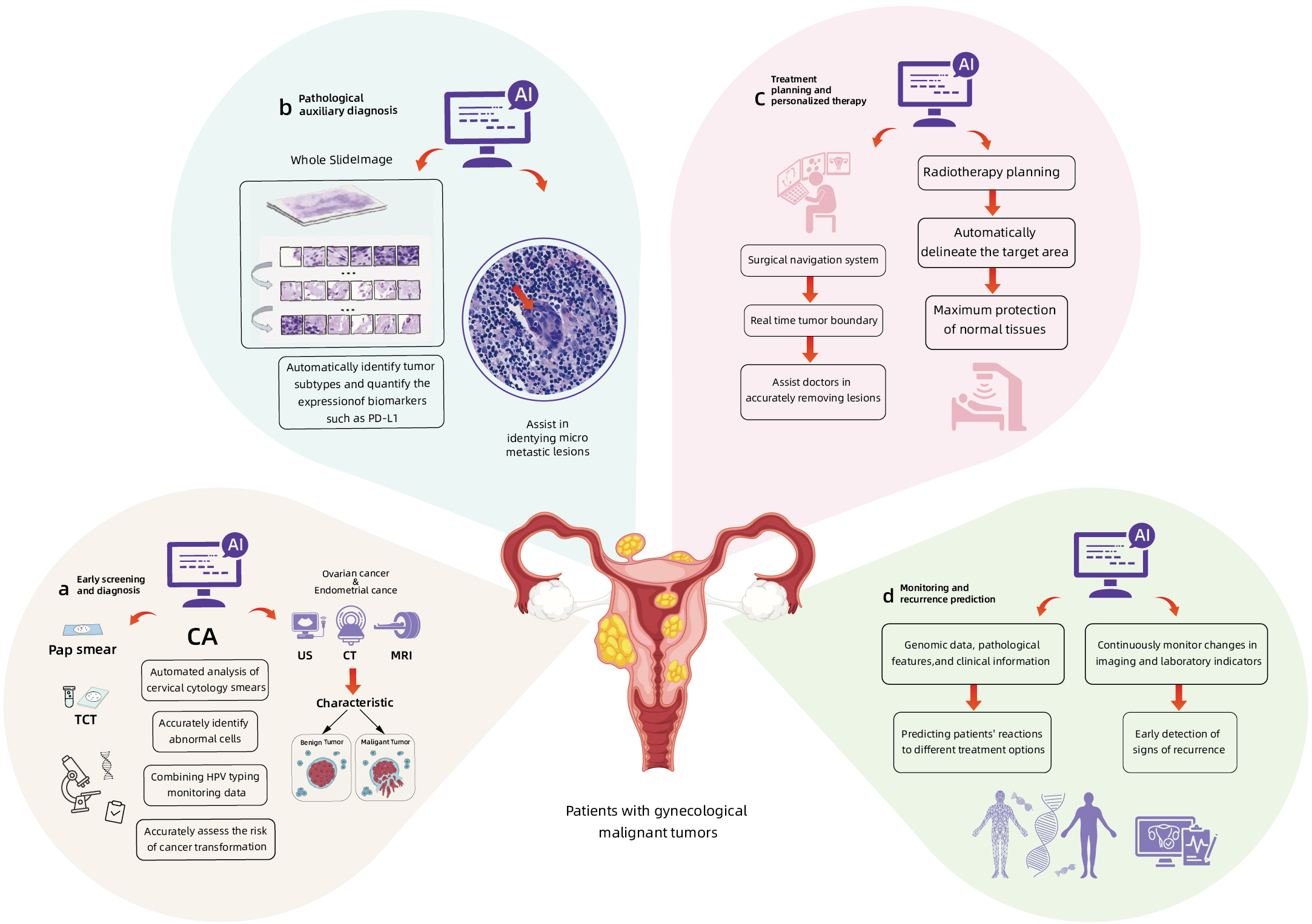 Diagram illustrating AI's role in managing gynecological malignant tumors. Four panels illustrate: a) Early screening with AI for cytology and cancer risk. b) AI-assisted pathological diagnosis identifying tumor subtypes and lesions. c) Treatment planning with AI for radiotherapy and surgical accuracy. d) Monitoring and predicting recurrence using genomic and clinical data. Central image of female reproductive system surrounded by tumor depictions.