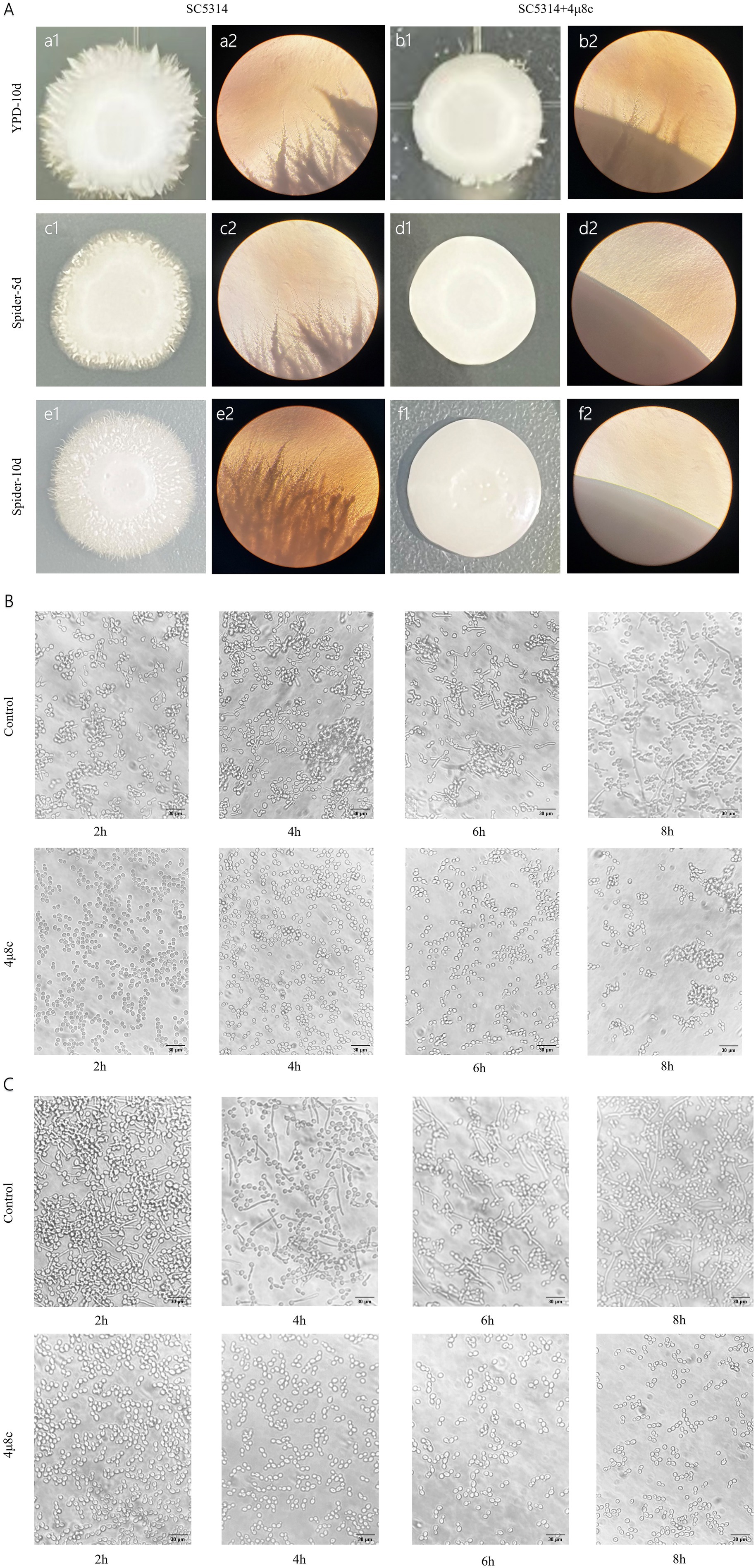 Panel A shows microscopic images of fungal colonies on YPD and Spider media. Columns a1 to f2 compare growth patterns between strains SC5314 and SC5314+4u&c over days. Panel B contains time-lapse images of cell cultures under control and 4u&c conditions at two, four, six, and eight hours, highlighting differences in cell morphology and aggregation. Eight-panel microscopy image showing cell samples labeled as Control and treated with a condition labeled as 4μ8c over time intervals of two, four, six, and eight hours. Each image shows variations in cell clustering and morphology, with noticeable differences between the Control and 4μ8c samples over time. Scale bars indicate 30 micrometers.