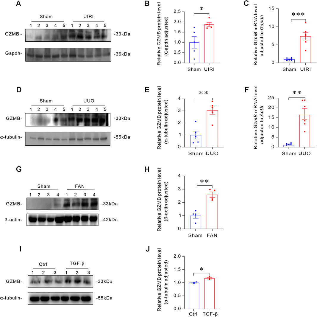 Western blot and bar graphs display protein levels of Granzyme B (GZMB) under various conditions. Panels A, D, G, I show protein blots for Sham, UIRI, UUO, FAN, and TGF-β treatments, with corresponding controls Gapdh, α-tubulin, and β-actin. Panels B, E, H, J present bar graphs quantifying relative GZMB protein levels, showing significant increases post-treatment compared to controls with statistical significance indicated by asterisks.