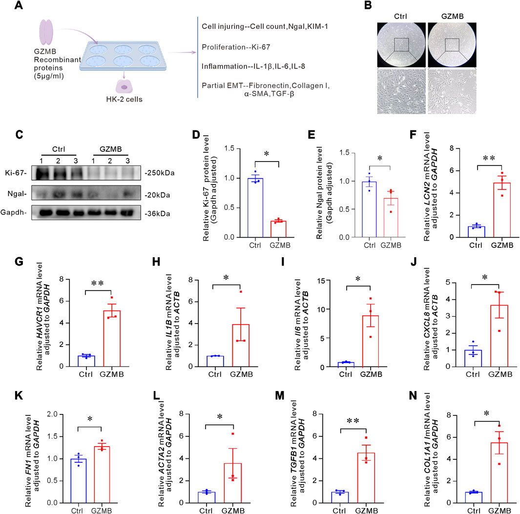Diagram composed of multiple panels illustrates the effects of GZMB on HK-2 cells. Panel A shows a flowchart of experimental setup with GZMB recombinant proteins. Panel B contains microscopic images showing cellular morphology differences between control and GZMB-treated groups. Panel C presents Western blot images for Ki-67, Ngal, and Gapdh proteins. Panels D to N display bar graphs comparing various protein and mRNA levels between control and GZMB-treated samples, with significant differences indicated by asterisks. The graphs represent cell proliferation, inflammation, and partial EMT markers.