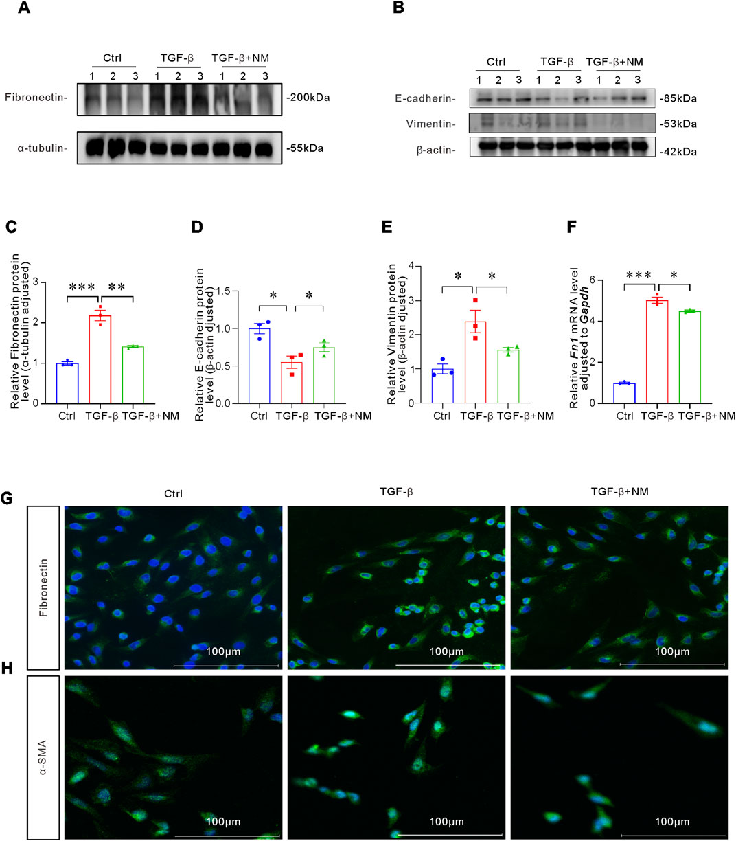Western blot and immunofluorescence analyses depict protein and mRNA levels in Ctrl, TGF-β, and TGF-β with NM groups. Panels A and B show expressions of Fibronectin, α-tubulin, E-cadherin, Vimentin, and β-actin. Bar charts C-F reveal relative protein and mRNA levels. Microscopy images G and H display Fibronectin and α-SMA staining. Statistical significance is marked with asterisks. Scale bars are 100 micrometers.