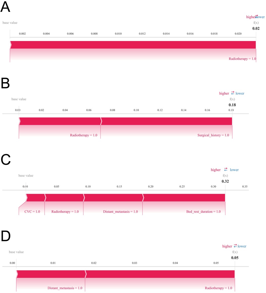 Four bar charts labeled A, B, C, and D show variable influences on a model's output. Chart A shows radiotherapy with a value of 0.02. Chart B shows radiotherapy and surgical history with a value of 0.18. Chart C displays CVC, radiotherapy, distant metastasis, and bed rest duration with a value of 0.32. Chart D highlights distant metastasis and radiotherapy with a value of 0.05. Each chart includes scales ranging from base values to the influence score.
