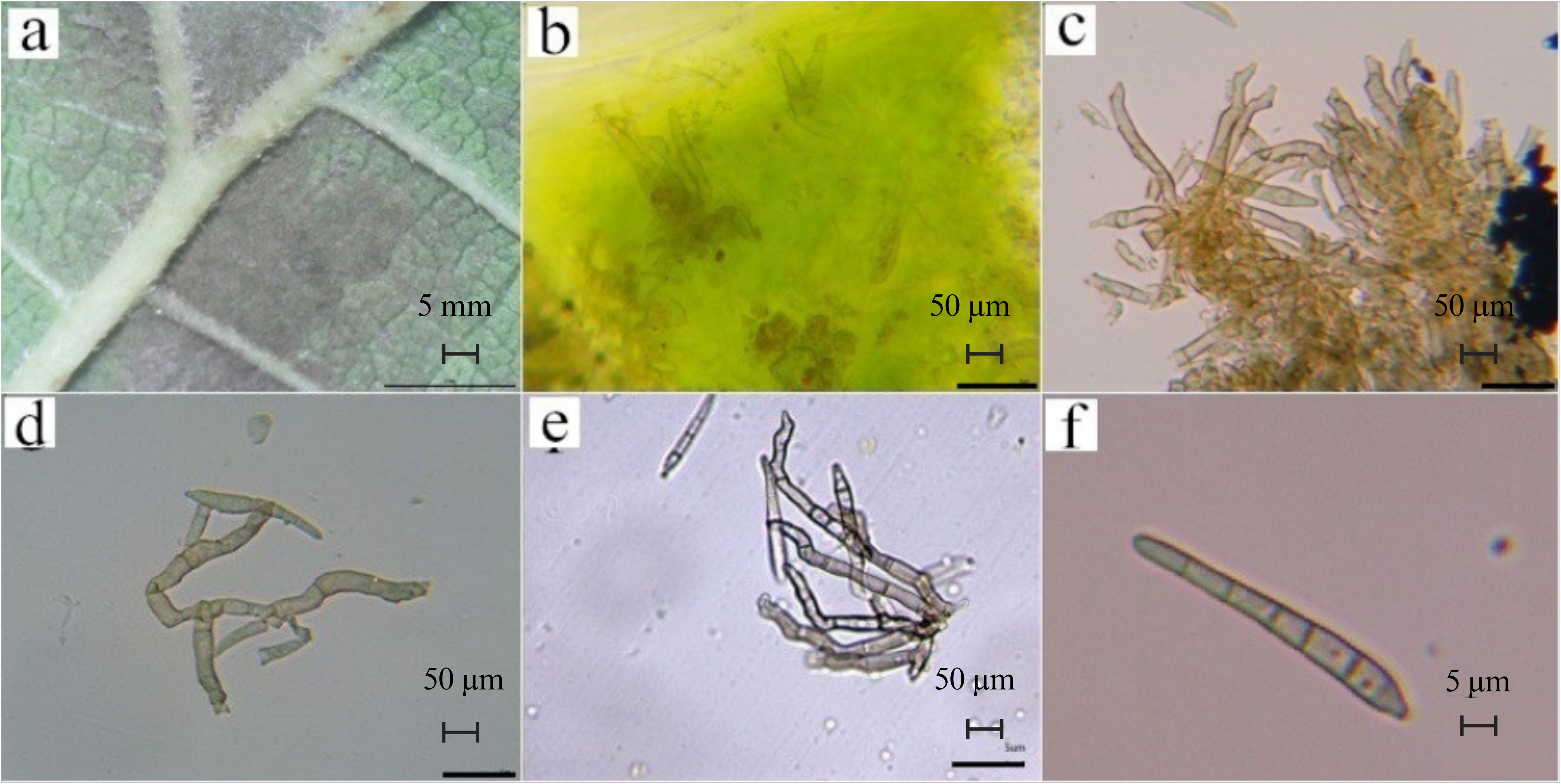 a. Close-up of a green leaf with visible texture and veins. b. Microscopic view of fungal structures on a green background, scale 50 micrometers. c. Cluster of branching fungal hyphae, scale 50 micrometers. d. Isolated fungal hyphae with septa, scale 50 micrometers. e. Group of thin, elongated hyphae, scale 50 micrometers. f. Single spore with septa, scale 5 micrometers.