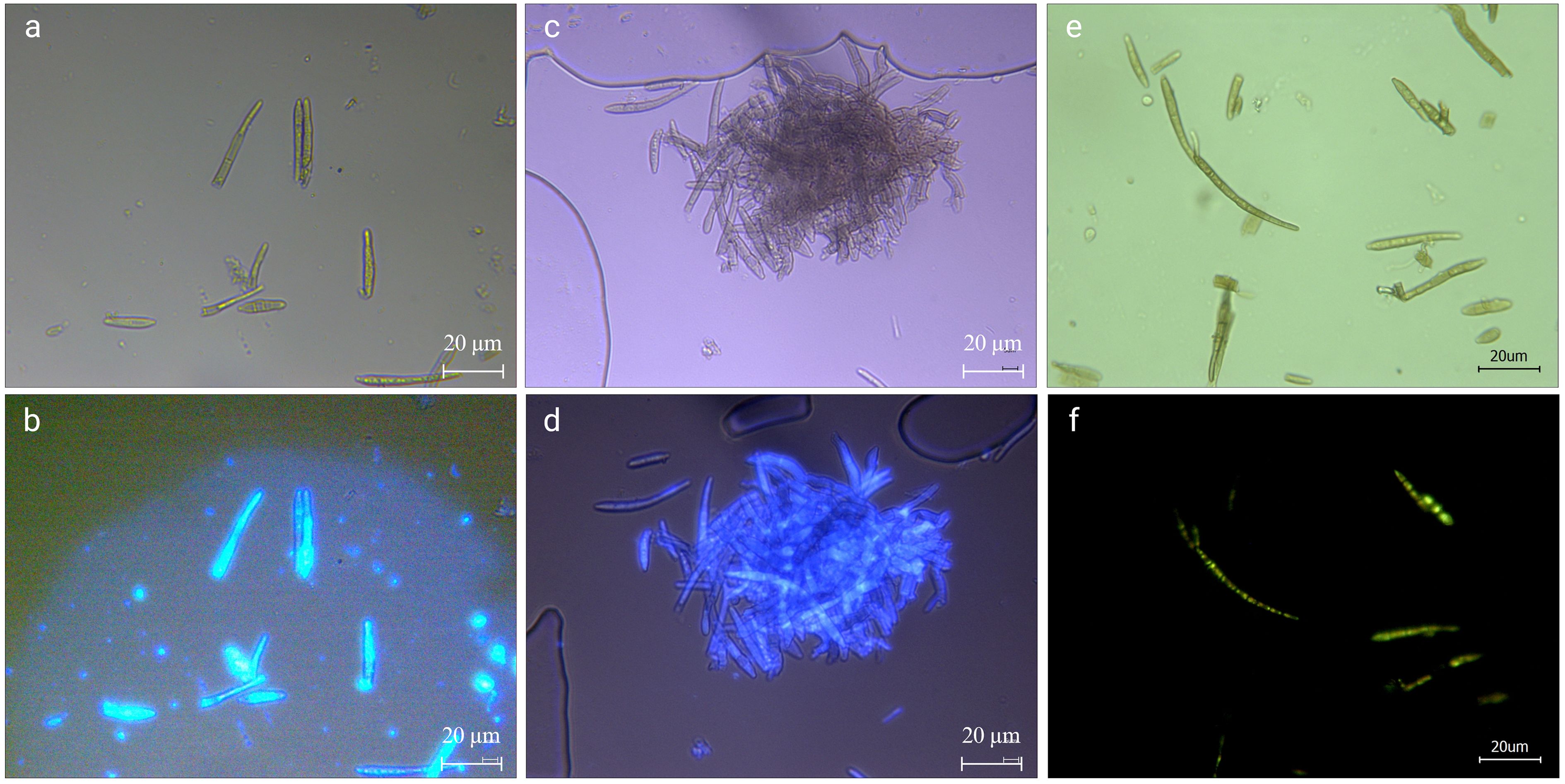 Microscopic images displaying various views of structures. Image (a) shows elongated structures under a light microscope. Image (b) depicts the same structures illuminated in blue under fluorescence. Image (c) shows a cluster of structures in a light microscope. Image (d) features the clustered structures highlighted in blue under fluorescence. Image (e) displays dispersed elongated structures in a light microscope. Image (f) presents these structures with green fluorescence against a black background. Each image includes a scale bar of twenty micrometers.