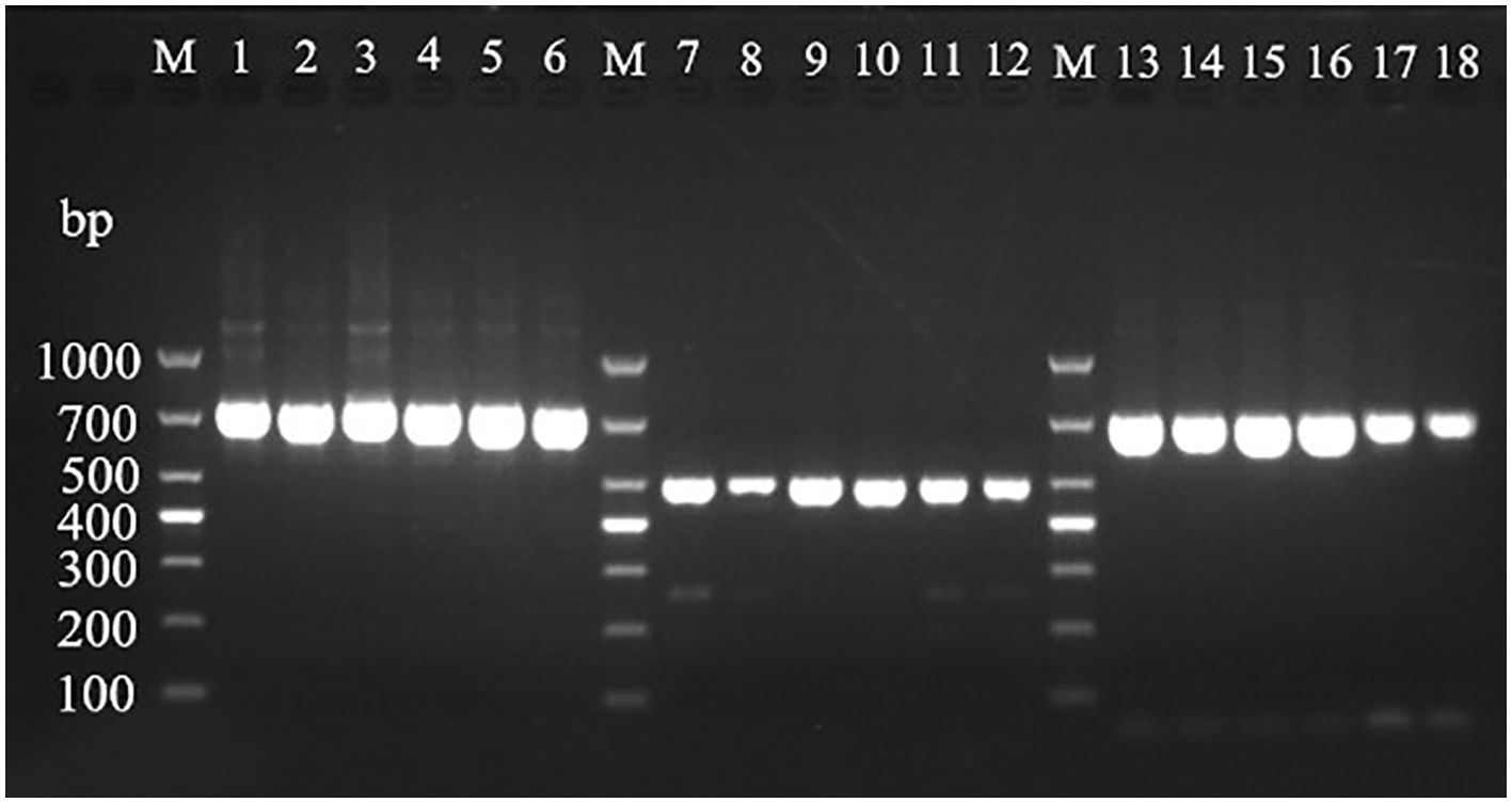 An agarose gel electrophoresis image showing DNA bands in lanes labeled with numbers one to eighteen. Lanes M represent the DNA ladder with bands at one thousand, seven hundred, five hundred, four hundred, three hundred, two hundred, and one hundred base pairs. Bright bands in various lanes indicate DNA fragments of different lengths.
