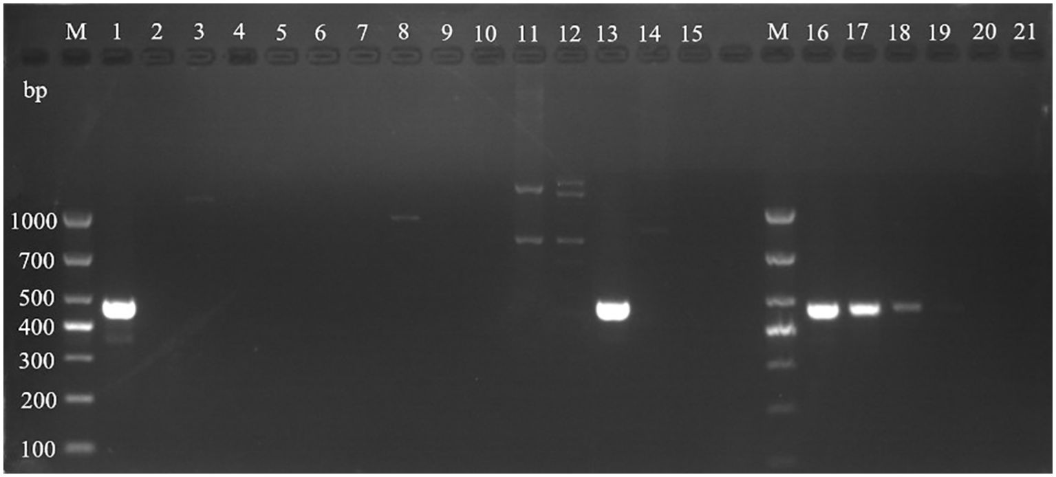 Gel electrophoresis image showing DNA bands across multiple lanes with a marker ladder indicating sizes from 100 to 1000 base pairs. Lanes are numbered 1 to 21, with varying band intensities visible, particularly in lanes 12, 13, 15, and 17. Marker lanes are labeled “M”.