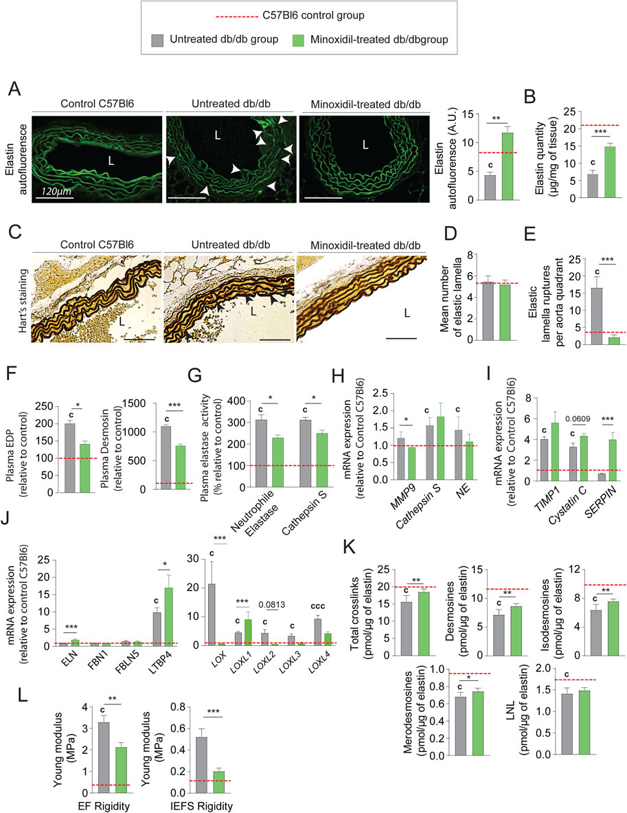 A multi-part scientific figure shows results from a study on elastin properties among three groups: Control C57Bl6, untreated db/db, and minoxidil-treated db/db. Part A displays Elastica fluorescence images with quantitative data in a bar graph showing increased elastin in the minoxidil-treated group. Part C presents Hart’s staining images with corresponding bar graphs measuring elastic amounts. Graphs B, D, E, F, G, H, I, J, K, and L illustrate various metrics like enzyme activity, mRNA expression, crosslinks, and rigidity, with notable differences evident across groups. Each graph uses different scales and units.