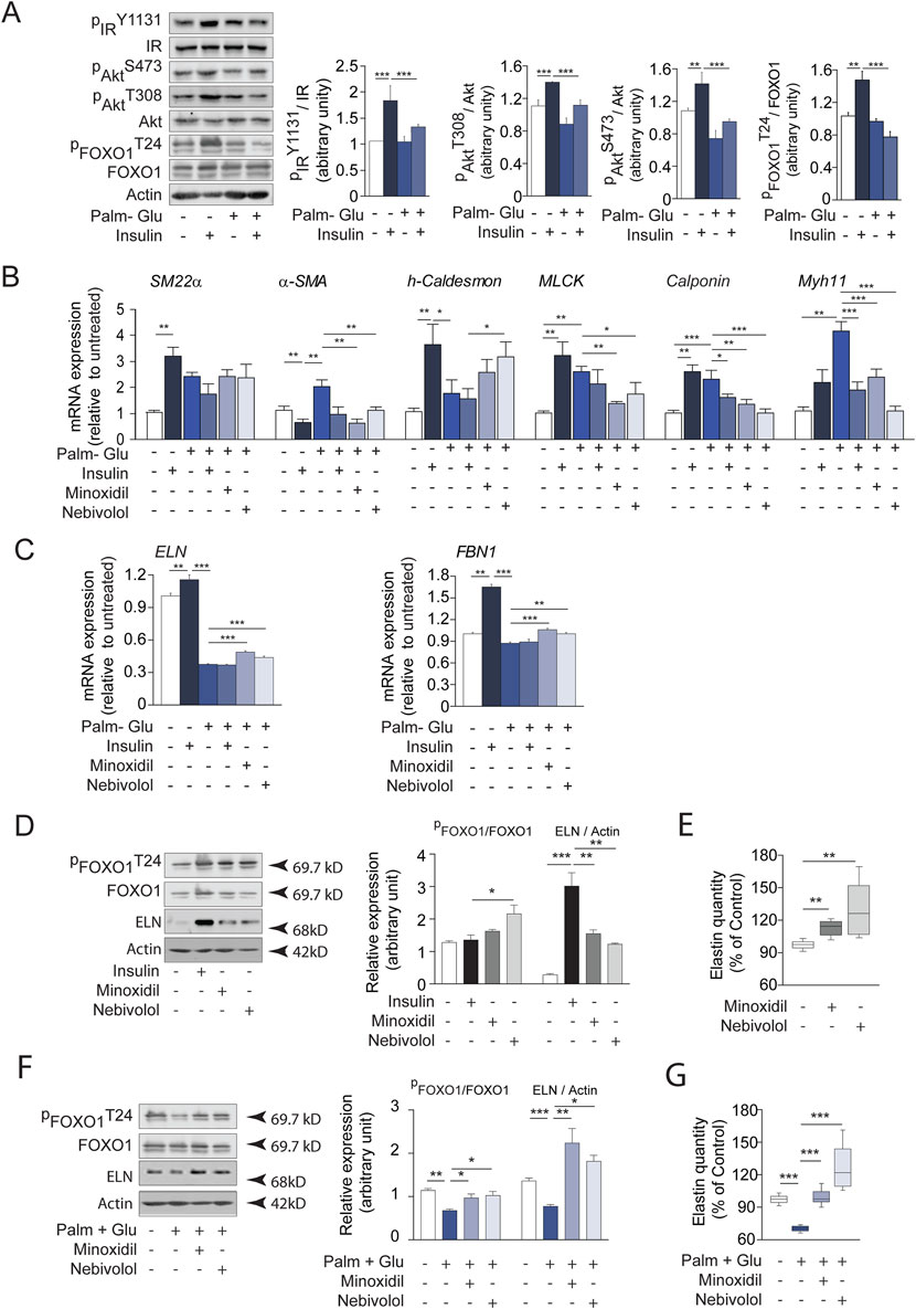 A series of charts and western blot images showing protein expression and mRNA levels. Panel A displays western blot bands of various proteins and their quantified bar graphs comparing different treatments with Palm-Glu and insulin. Panel B features bar graphs of mRNA expression levels of SM22α, α-SMA, h-Caldesmon, MLCK, Calponin, and Myh11 under different treatment conditions. Panel C shows ELN and FBN1 mRNA expression levels. Panel D presents a western blot and graphs for PFOXO1/FOXO1 and ELN/Actin expression levels in response to insulin, minoxidil, and nebivolol. Panel E has a box plot of elastin quantity with minoxidil and nebivolol treatments. Panel F includes a similar western blot to panel D, comparing Palm-Glu treatments. Panel G displays a box plot for elastin quantity under Palm-Glu, minoxidil, and nebivolol treatments. Statistical significance is indicated with asterisks.