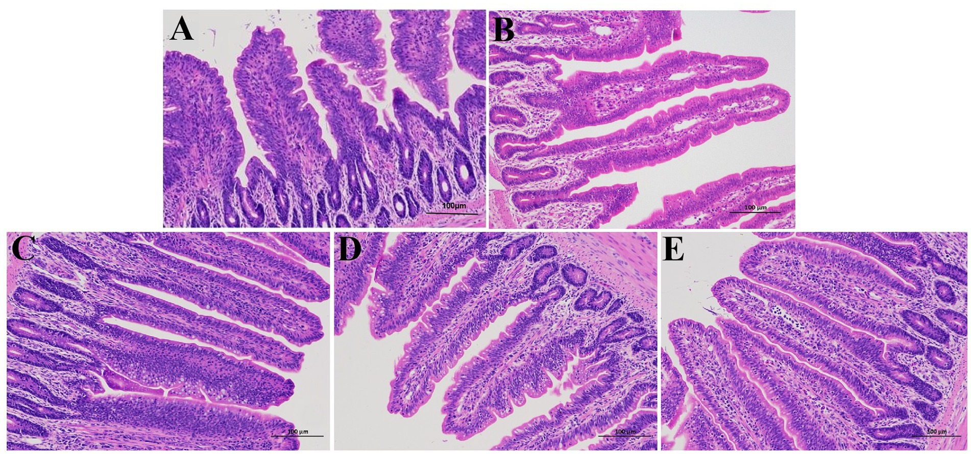 Histological images of intestinal villi stained with hematoxylin and eosin. Panels A to E show cross-sections with varying degrees of epithelial and cellular density. Each image illustrates the structural differences and arrangement of tissue. Scale bars indicate a magnification of one hundred micrometers.