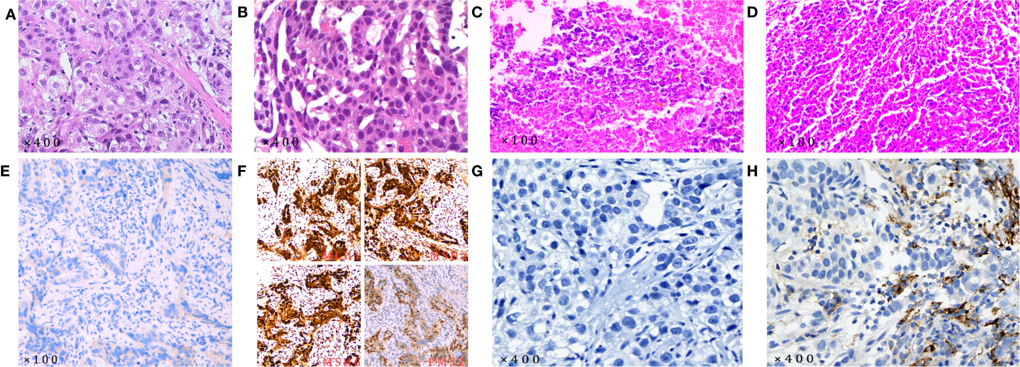 Microscopic images show eight different histological slides labeled A to H. Slides A and B are stained with hematoxylin and eosin at 400x magnification, highlighting cellular details. Slides C and D appear highly pink, indicating possible eosin staining at 100x. Slide E shows a less dense blue stain at 100x. Slide F contains four images of brown-stained tissue sections labeled with unknown markers. Slides G and H present blue-stained cells at 400x, possibly indicating a specific staining technique.