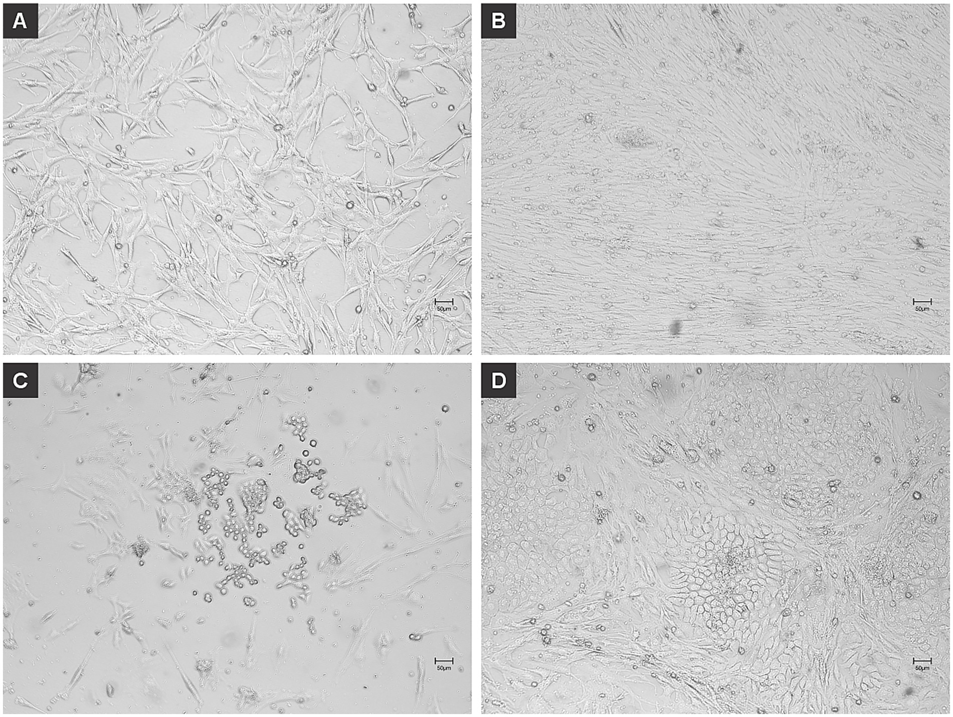 Four micrograph images labeled A, B, C, and D showing different cell cultures. Image A displays long, spindle-shaped cells dispersed across the field. Image B shows elongated, densely packed cells oriented in parallel. Image C features clustered cells forming aggregates in a scattered pattern. Image D exhibits dense, cobblestone-like cells with distinct borders. Scale bars indicate the magnification.