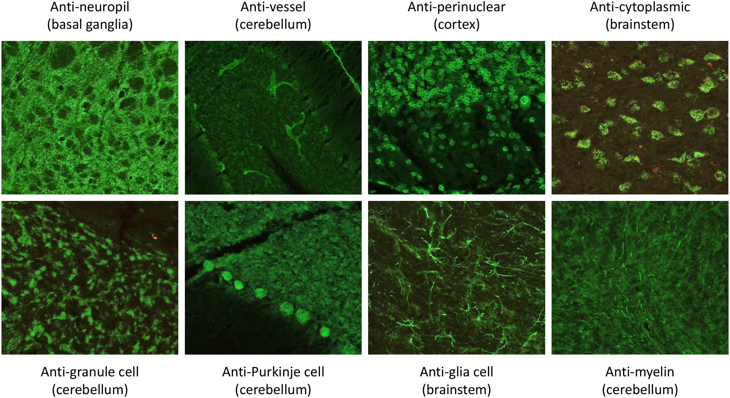 Tissue-based assay findings showing different antibody binding patterns on mouse brain slices. Top row: anti-neuropil (basal ganglia), anti-vessel (cerebellum), anti-perinuclear (cortex), anti-cytoplasmic (brainstem). Bottom row: anti-granule cell (cerebellum), anti-Purkinje cell (cerebellum), anti-glia cell (brainstem), anti-myelin (cerebellum). The brain regions represented are in brackets.