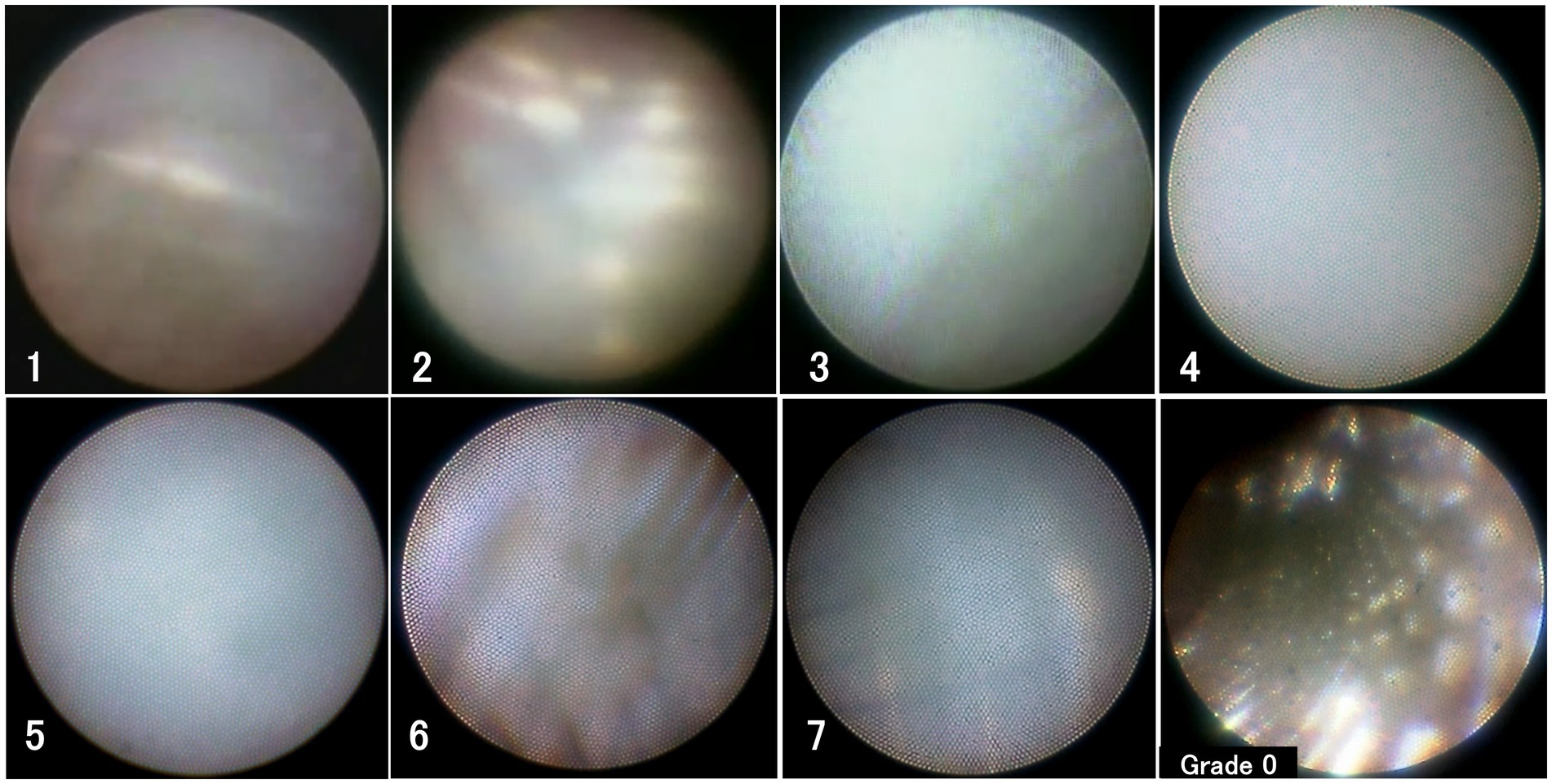 Eight microscopy images showing different stages of skin grading. Images display varying textures and illumination levels, labeled one to seven and