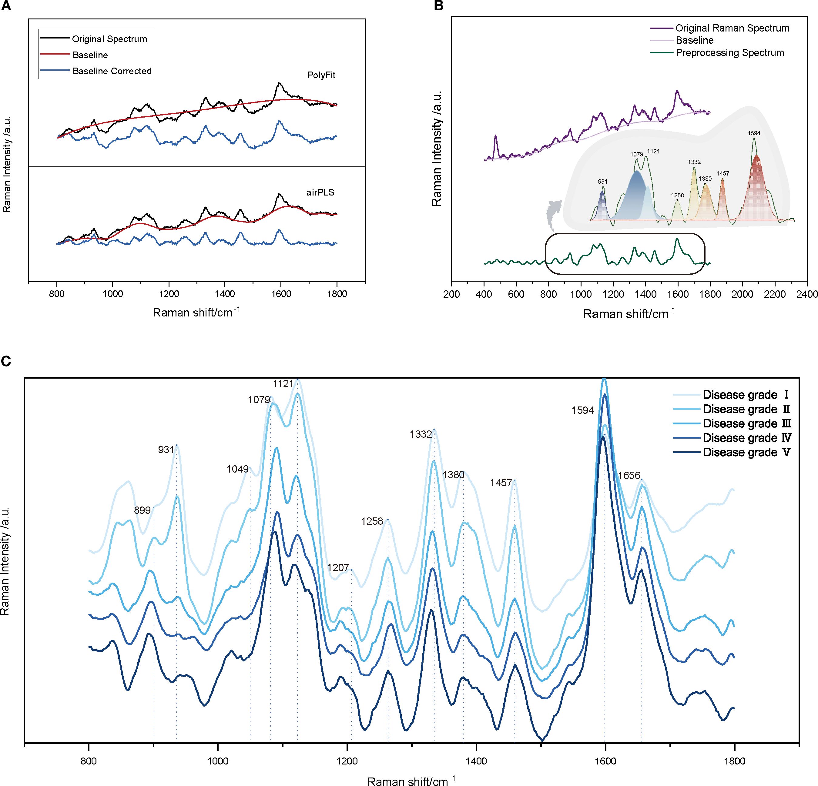 Graphical representations of Raman spectra. Panel A shows baseline correction using PolyFit and airPLS methods. Panel B illustrates original, baseline, and preprocessed spectra with highlighted peaks. Panel C compares Raman spectra for five disease grades, showing intensity variations across grades.