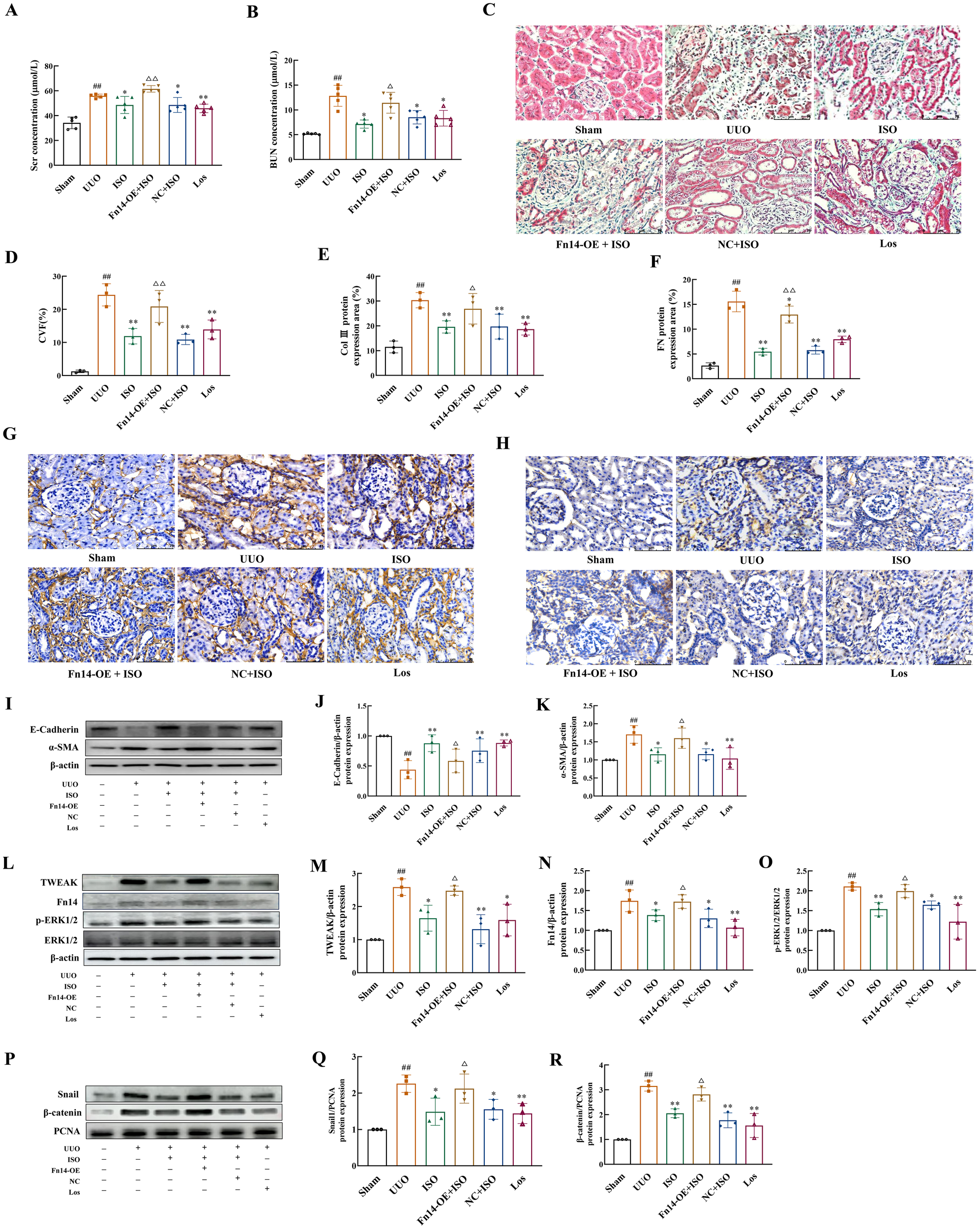The figure consists of multiple panels showing data related to kidney function and protein expression in different experimental groups: Sham, UUO, ISO, Fn14-OE + ISO, NC+ISO, and Los. Panels A, B, D, E, F, J, K, M, N, O, Q, and R depict bar graphs of serum creatinine, BUN, collagen volume fraction, collagen III, FN, E-cadherin, α-SMA, TWEAK, p-ERK1/2, β-catenin, Snail, and PCNA levels, respectively. Panels C, G, and H include histological images showing tissue staining. Panels I, L, and P consist of Western blot results for protein analysis. The graphs and images compare the effects of different treatments on kidney injury markers.