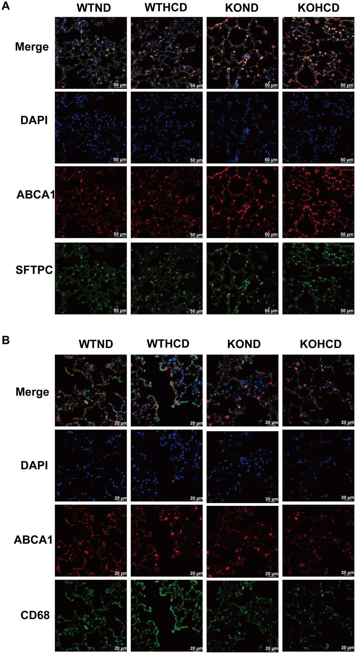 Two panels labeled A and B show immunofluorescence staining of lung tissue. Each panel includes four columns representing different conditions: WTND, WTHCD, KOND, and KOHCD. In panel A, rows depict merged images, DAPI, ABCA1, and SFTPC staining, with scale bars of 50 micrometers. Panel B displays the same format, but with CD68 staining instead of SFTPC, and a scale bar of 20 micrometers. Various colors (blue, red, green) correspond to different markers.