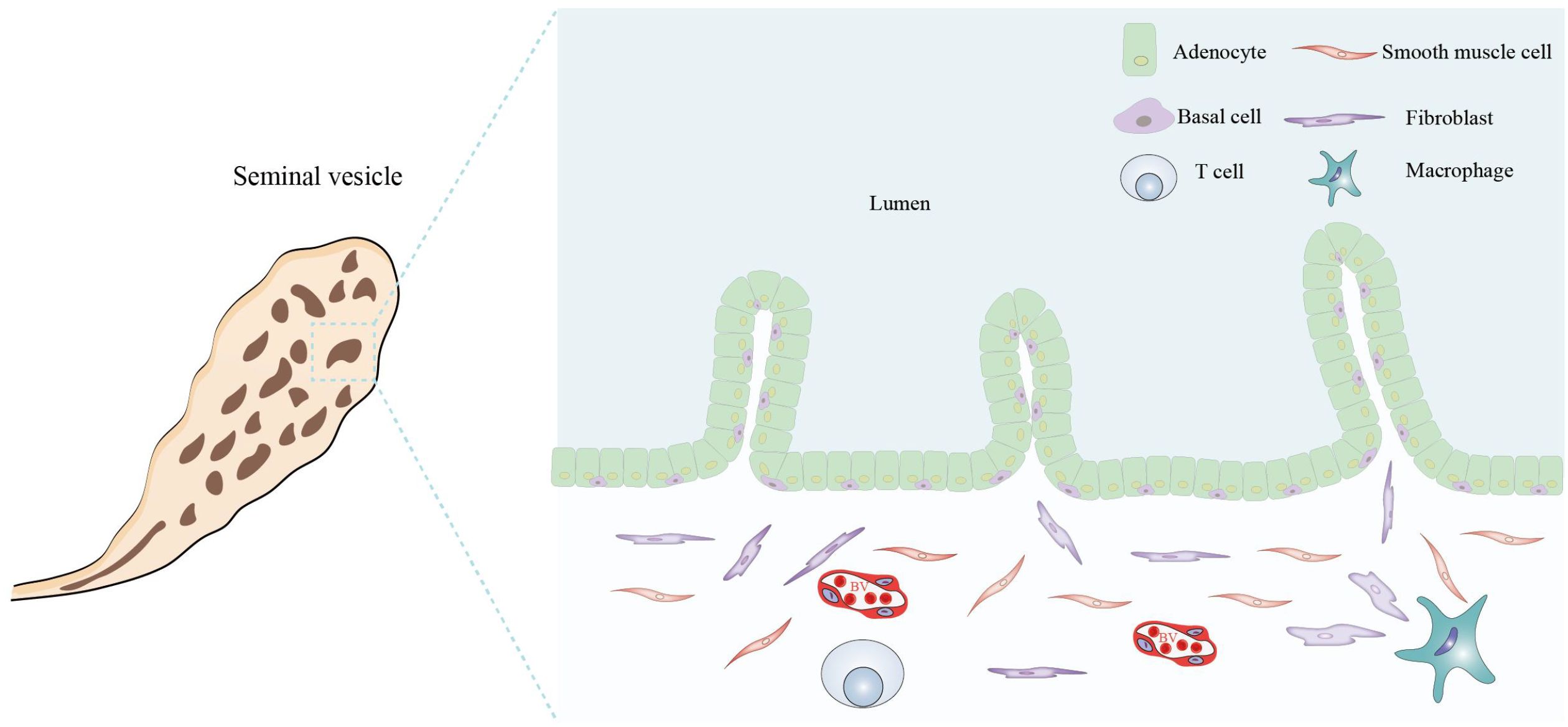 Cross-sectional illustration of a seminal vesicle. The diagram shows a detailed view of the tissue structure and cell types including adenocytes, basal cells, smooth muscle cells, fibroblasts, T cells, and macrophages. The lumen is lined with adenocytes, and surrounding cells include smooth muscle and fibroblasts. A color-coded legend identifies each cell type.