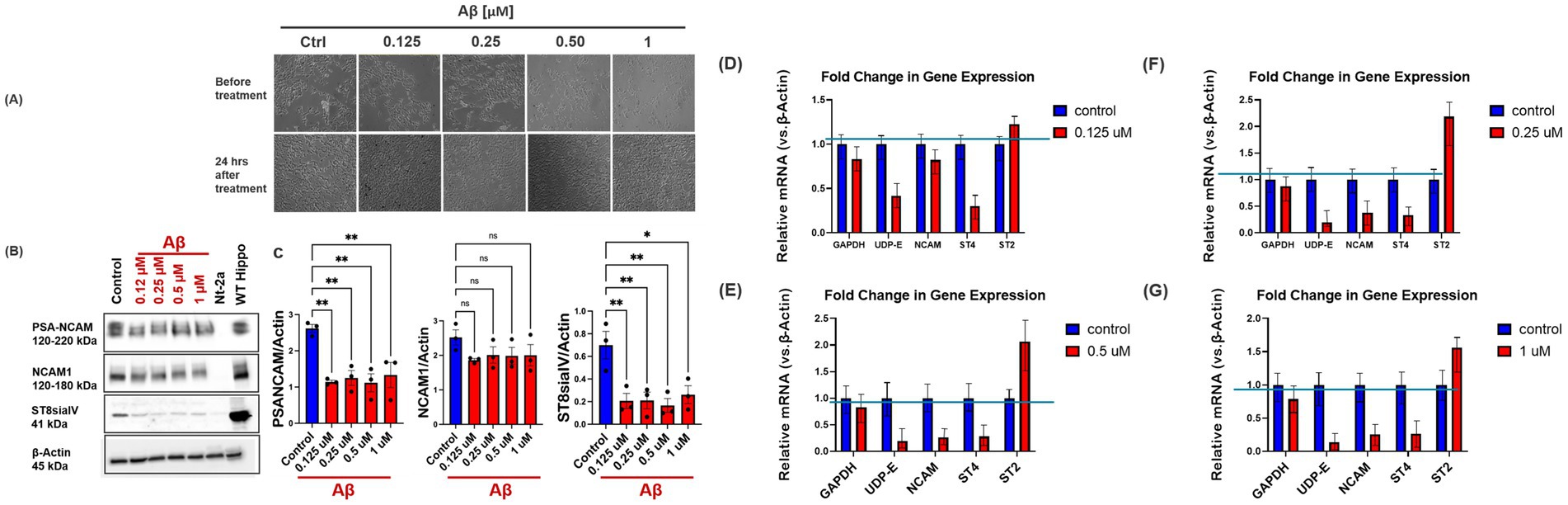Panels display experimental results related to amyloid beta (Aβ) treatment. (A) Microscopy images show cell morphology before and after 24 hours at various Aβ concentrations. (B) Western blot results for PSA-NCAM, NCAM1, and ST8siaIV proteins with actin as a control. (C) Bar graph shows quantification of protein levels relative to actin. (D-G) Bar charts depict fold change in mRNA expression levels for genes GAPDH, UDP-E, NCAM, ST4, and ST2 at different Aβ concentrations compared to controls. Statistical significance is indicated by asterisks.