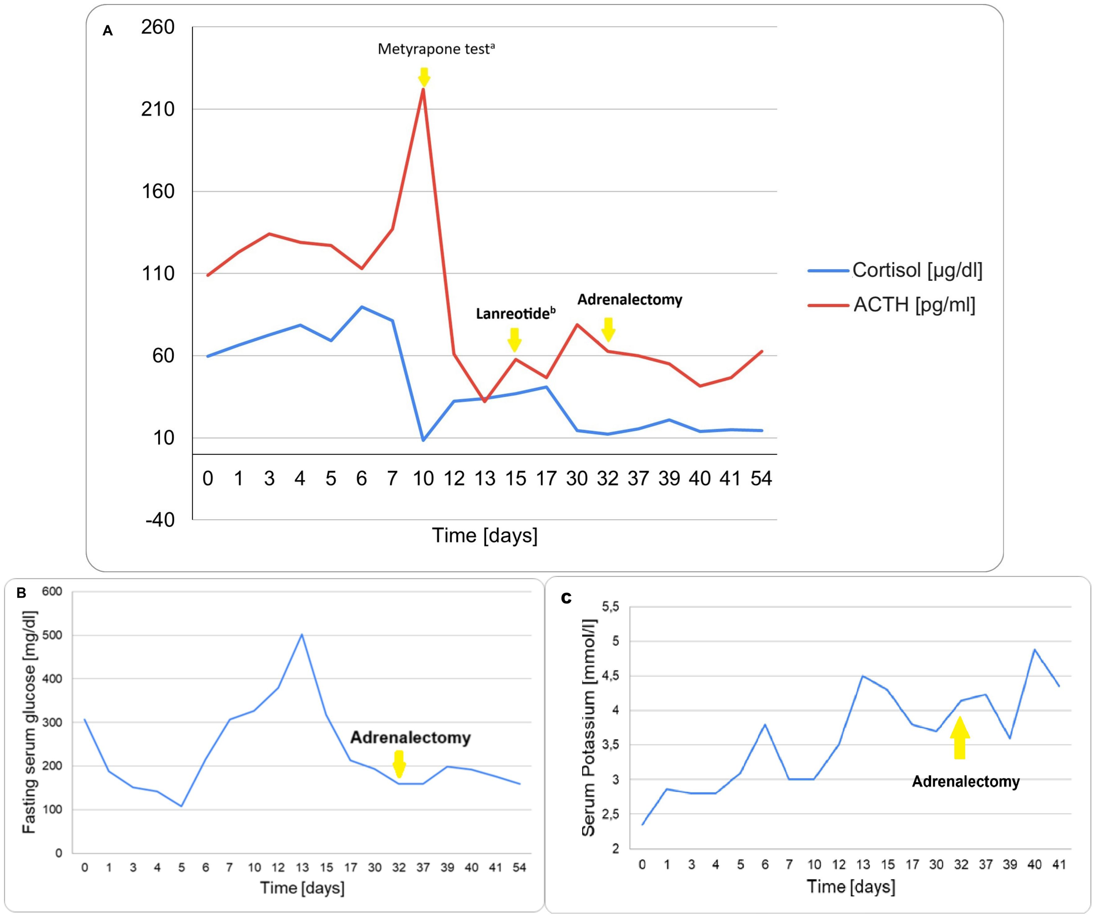 Graphs illustrating changes in hormone and metabolic levels over time. Panel A shows cortisol (blue) and ACTH (red) levels, with key events marked: metyrapone test, lanreotide treatment, and adrenalectomy. Panel B presents fasting serum glucose levels over time, with adrenalectomy indicated. Panel C displays serum potassium levels over time, also highlighting the timing of adrenalectomy.