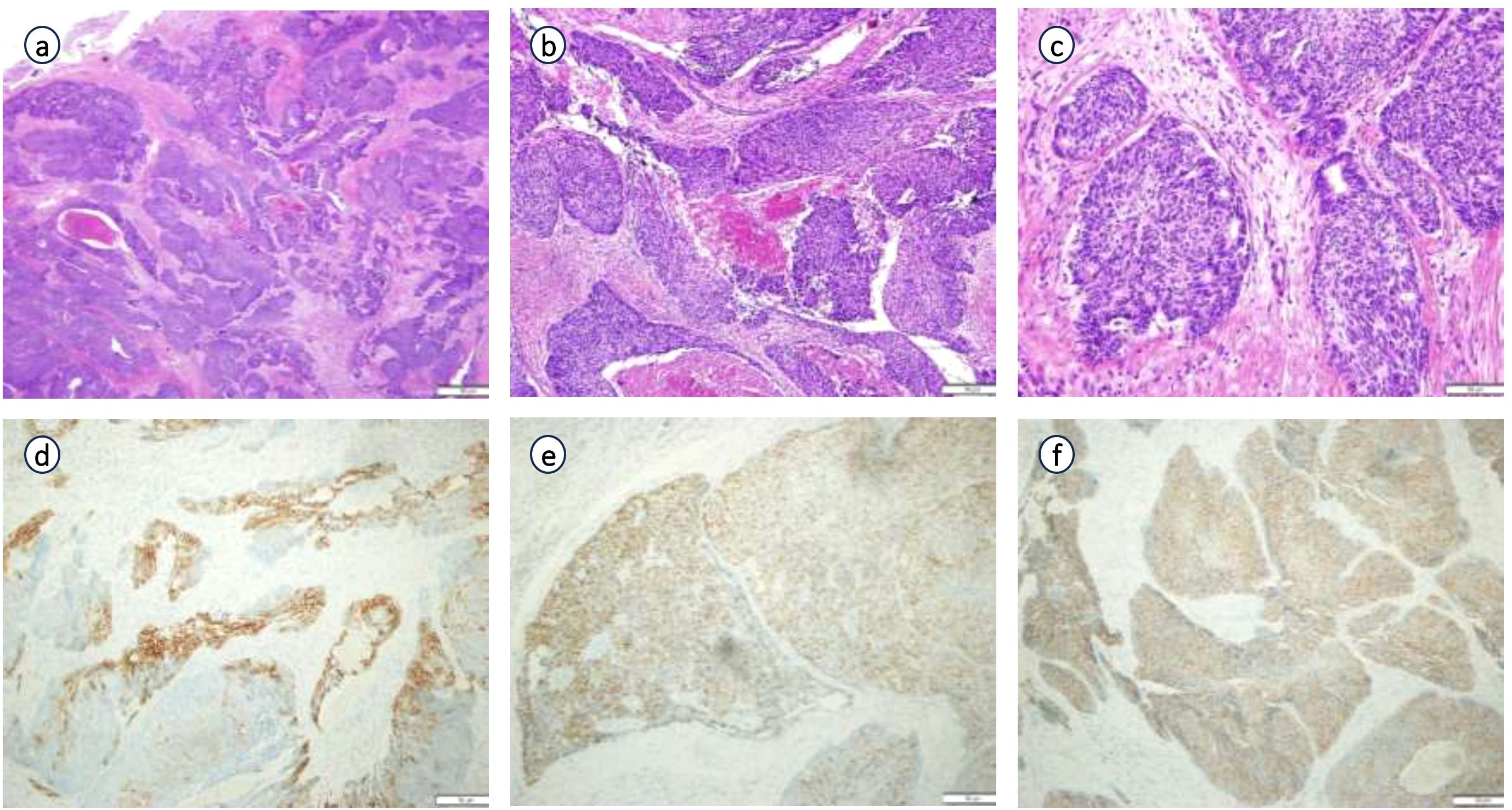 Six microscopy images of tissue sections. Images a to c show hematoxylin and eosin staining with varying patterns of purple and pink, indicating different tissue structures. Images d to f display immunohistochemical staining with lighter and brownish areas, highlighting specific tissue components. Each image has a circular label from a to f.