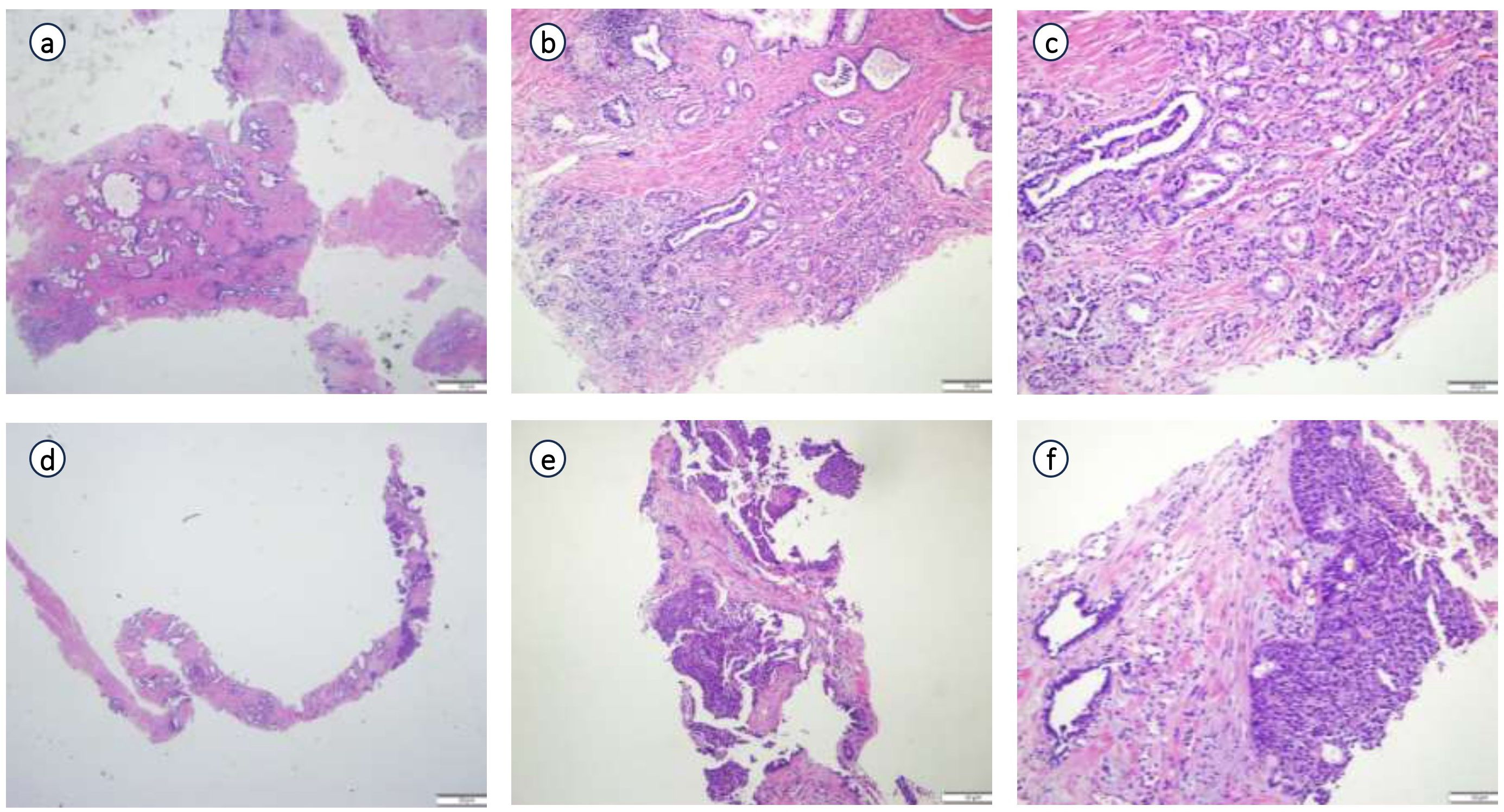 Histological images showing tissue samples, labeled a to f. Each panel displays different tissue structures stained in pink and purple, indicating cellular and extracellular components. The variations in patterns and density suggest different tissue types or conditions, with some images showing more complex glandular formations and others displaying simpler structural arrangements.