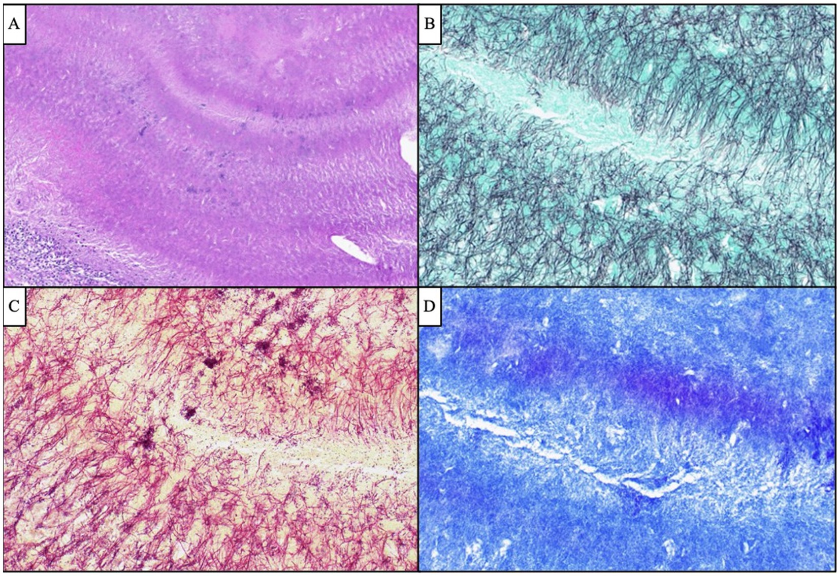 Histological stained sections of different tissues shown in a four-panel layout. Panel A shows a hematoxylin and eosin-stained tissue, displaying shades of pink and purple. Panel B presents a tissue stained with black fibers on a turquoise background. Panel C features a bright red-stained tissue with a yellowish background. Panel D depicts a tissue stained in shades of blue and purple. Each panel highlights various histological structures and staining techniques.