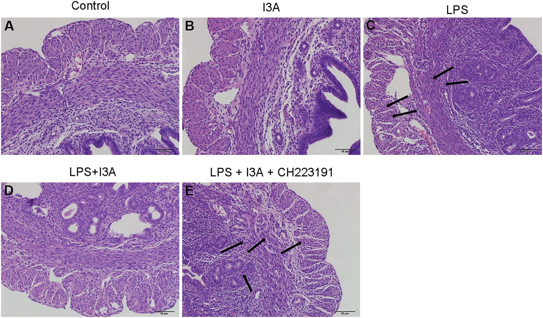 Histological comparison of colon tissues under different conditions: Panel A shows control tissue with normal histology. Panel B displays tissue treated with I3A, showing slight changes. Panel C highlights inflammation in LPS-treated tissue, indicated by arrows. Panel D shows LPS plus I3A treatment with moderated changes. Panel E illustrates tissue with LPS, I3A, and CH223191, showing visible inflammation reduction, indicated by arrows. All images are stained with hematoxylin and eosin, magnified equally.