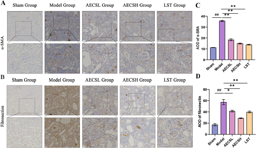 Histological analysis images and bar graphs comparing expression levels in different groups. Panels A and B show stained tissue sections for α-SMA and fibronectin across Sham, Model, AECSL, AECSH, and LST groups with enlargements. Panels C and D present bar graphs indicating average optical density (AOD) for α-SMA and fibronectin, respectively. Significant differences are marked by asterisks.