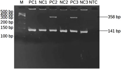 Gel electrophoresis image showing DNA bands. Lanes are labeled as M, PC1, NC1, PC2, NC2, PC3, NC3, and NTC. Marker lane M has bands labeled from 100 to 500 base pairs. Prominent bands appear at 358 base pairs and 141 base pairs in several lanes.