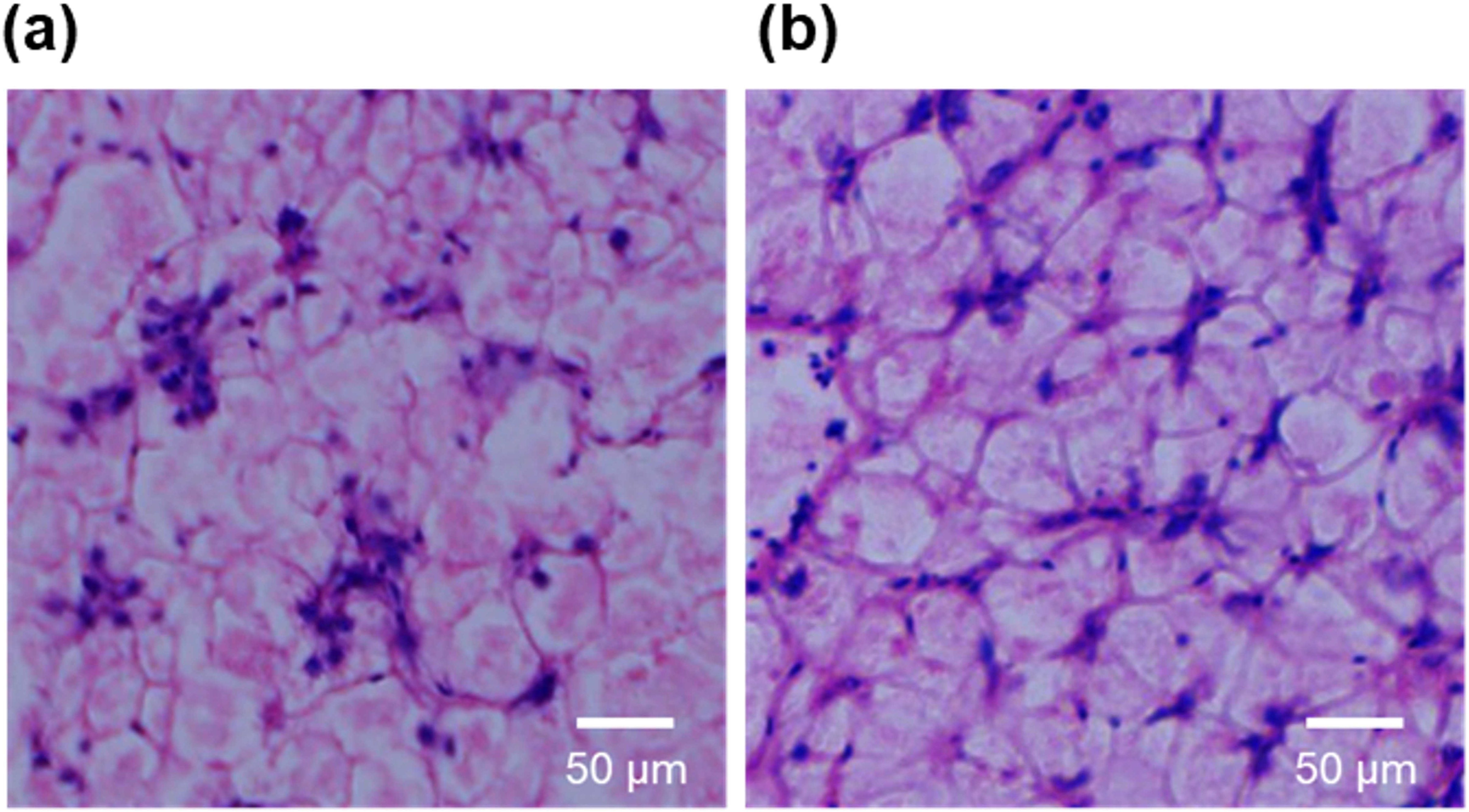 Two microscopic images labeled (a) and (b). Both show pink and purple-stained cellular structures. Image (a) has a denser cluster of stained areas, while image (b) appears more evenly distributed. Both have a scale bar indicating 50 micrometers.