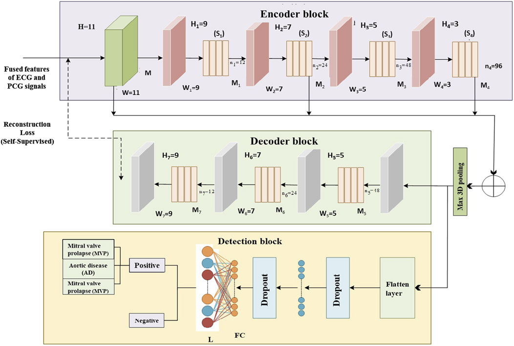 Diagram showing a three-part neural network architecture. The encoder block processes fused ECG and PCG features with decreasing dimensions. The decoder block reverses the process using reconstruction loss for self-supervision. The detection block analyzes outputs for mitral valve prolapse and aortic disease, using dropout, a flatten layer, and fully connected layers, followed by maximum three-dimensional pooling.