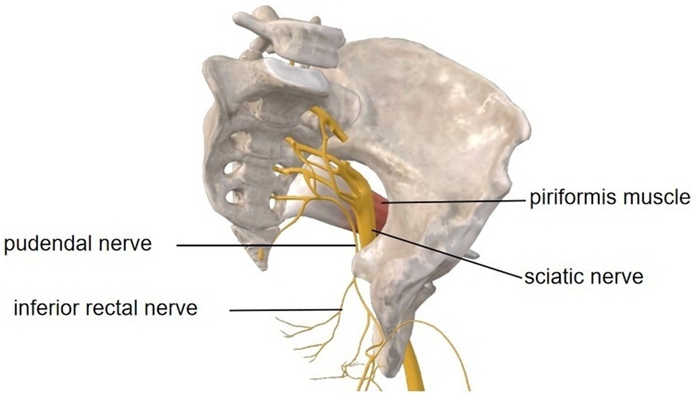 Anatomical illustration showing the pelvis from a lateral view, highlighting the pudendal nerve, inferior rectal nerve, sciatic nerve, and piriformis muscle. The nerves are shown in yellow, branching from the sacral region, while the piriformis muscle is depicted in red. Image courtesy of 3D Body (Shanghai, V8.8.51, Copyright obtained from Third Body Digital Technology Co., Ltd.).