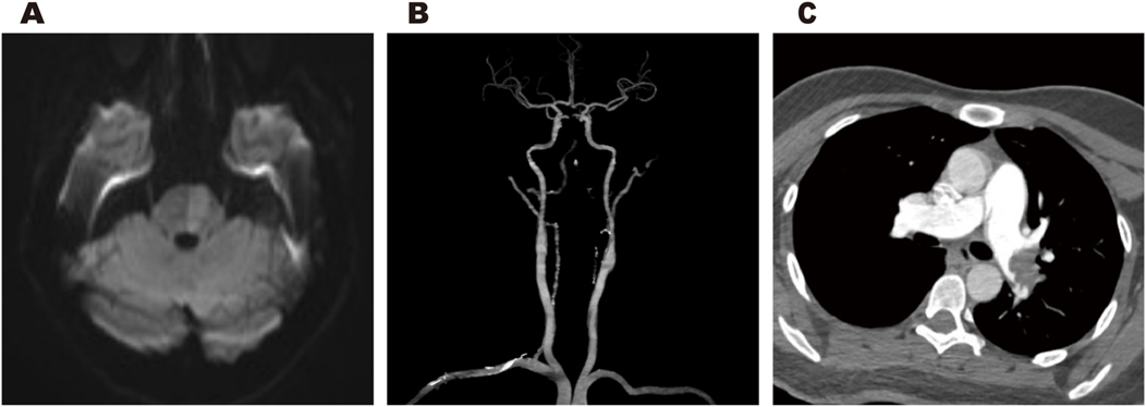 Panel A shows a grayscale MRI scan of the brain, highlighting cerebral structures. Panel B presents an angiogram of the carotid arteries, displaying clear arterial pathways. Panel C is a CT scan of the chest, detailing the thoracic cavity, including the heart and lungs.