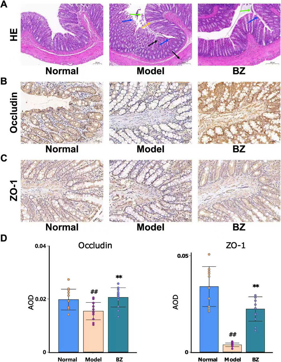 Histological and immunohistochemical analysis of intestinal tissue in three conditions: Normal, Model, and BZ. Panel A shows HE stained sections. Panels B and C show Occludin and ZO-1 expression, respectively, with differences in staining intensity among conditions. Panel D presents bar graphs comparing the average optical density of Occludin and ZO-1 across the three conditions, highlighting statistical significance with symbols.