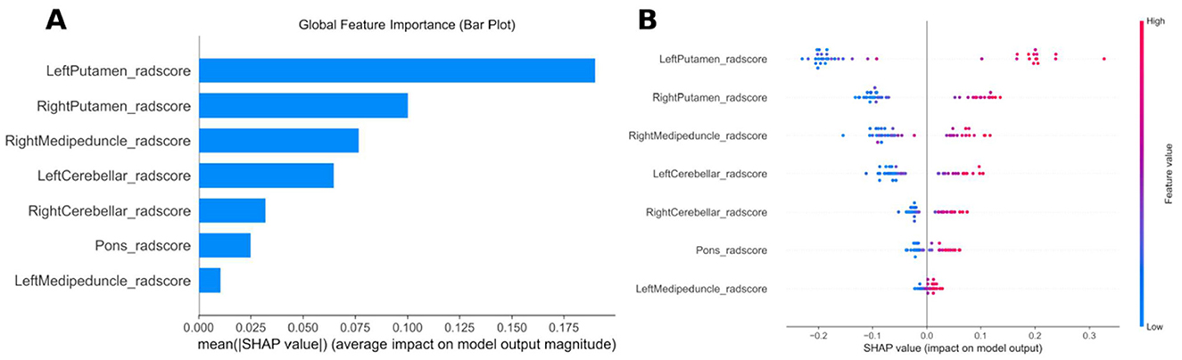 Panel A is a horizontal bar chart displaying global feature importance, with LeftPutamen_radscore having the highest SHAP value. Panel B is a scatter plot showing SHAP values for the same features, with color indicating feature values from low (blue) to high (red).