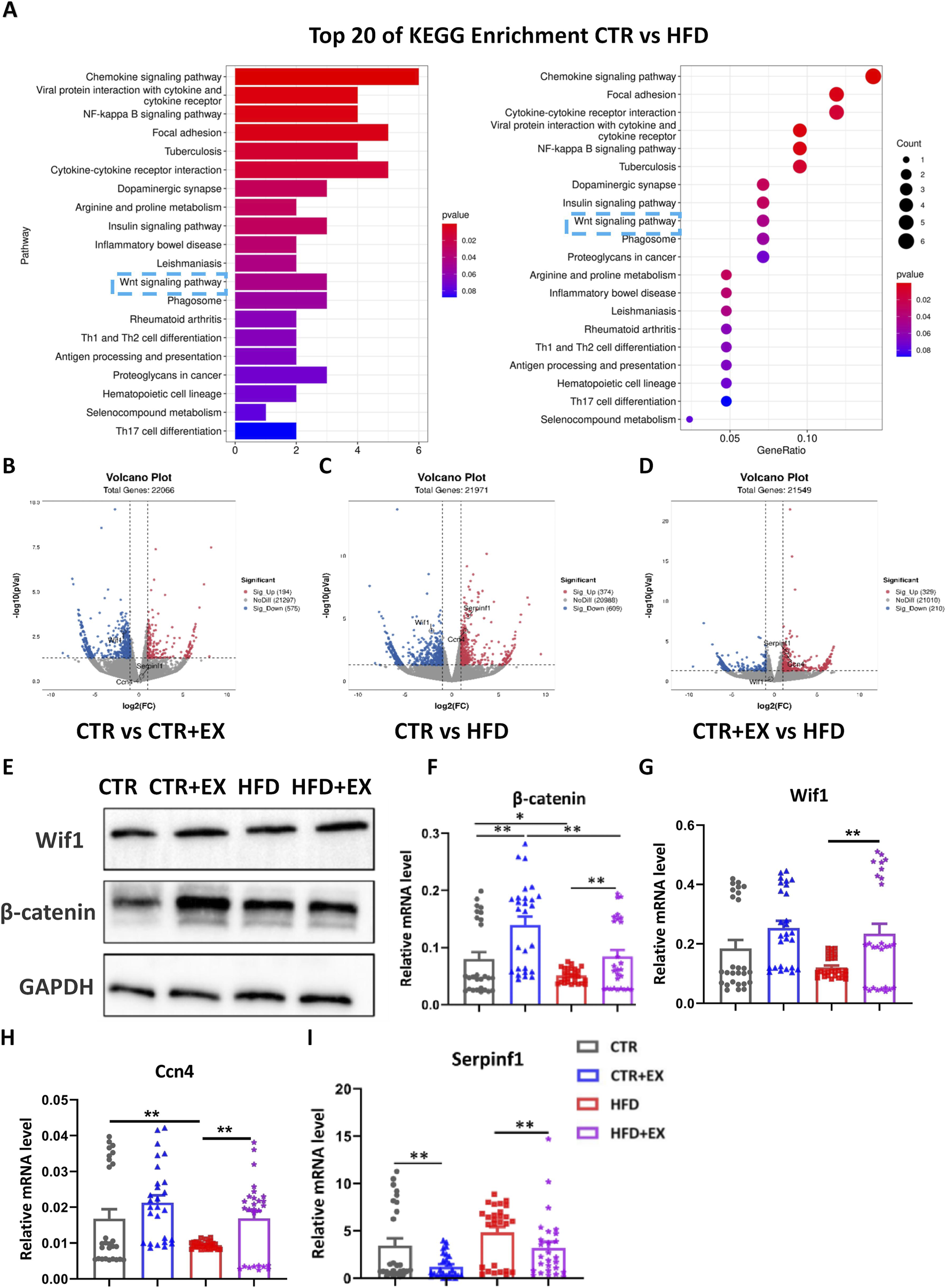 The image contains multiple panels related to gene expression analysis and pathway enrichment. Panel A shows bar and dot plots of the top 20 KEGG pathway enrichments comparing CTR and HFD, with color indicating p-values. Panels B, C, and D are volcano plots displaying different gene expressions between groups (CTR vs. CTR+EX, CTR vs. HFD, and CTR+EX vs. HFD) with genes marked as significantly up or down-regulated. Panel E shows western blot results for Wif1, β-catenin, and GAPDH across different conditions. Panels F, G, H, and I present bar graphs comparing relative mRNA levels of specific genes (β-catenin, Wif1, Ccn4, and Serpinf1) across different conditions, with statistical significance indicated.