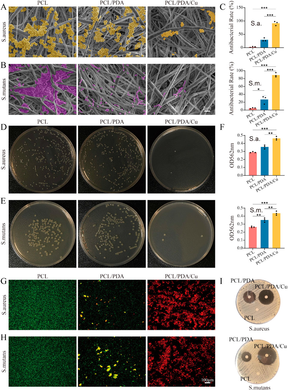 Composite image showing antibacterial properties of different PCL-based materials. Panels A and B: Electron microscopy images showing bacterial adhesion of S. aureus and S. mutans on PCL, PCL/PDA, and PCL/PDA/Cu surfaces. Panel C: Bar graphs displaying antibacterial rates for both bacteria on each surface. Panels D and E: Petri dishes demonstrating bacterial colony growth for each material and bacterial type. Panel F: Bar graphs of OD562nm values indicating antibacterial effectiveness. Panels G and H: Fluorescent images showing live/dead staining for S. aureus and S. mutans. Panel I: Zone of inhibition tests with S. aureus and S. mutans on the materials.