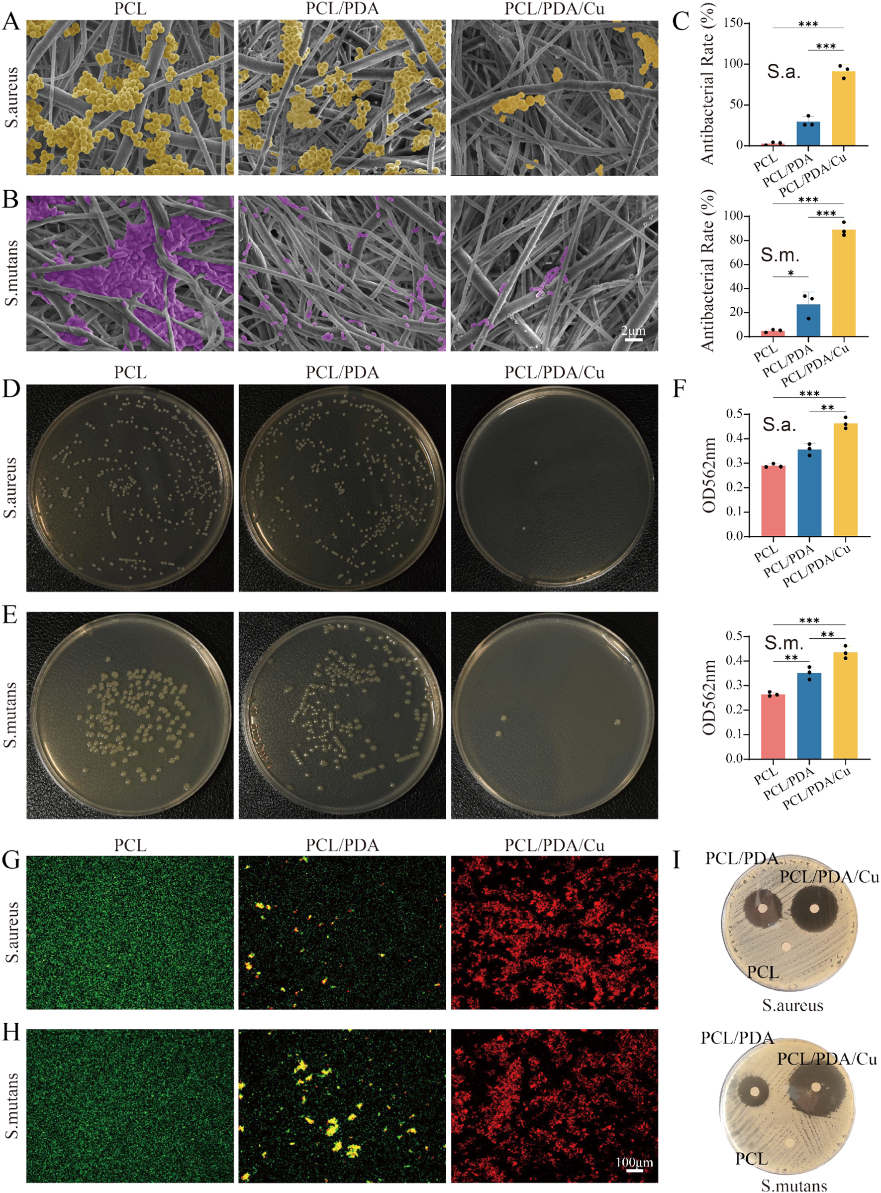 Composite image showing antibacterial properties of different PCL-based materials. Panels A and B: Electron microscopy images showing bacterial adhesion of S. aureus and S. mutans on PCL, PCL/PDA, and PCL/PDA/Cu surfaces. Panel C: Bar graphs displaying antibacterial rates for both bacteria on each surface. Panels D and E: Petri dishes demonstrating bacterial colony growth for each material and bacterial type. Panel F: Bar graphs of OD562nm values indicating antibacterial effectiveness. Panels G and H: Fluorescent images showing live/dead staining for S. aureus and S. mutans. Panel I: Zone of inhibition tests with S. aureus and S. mutans on the materials.
