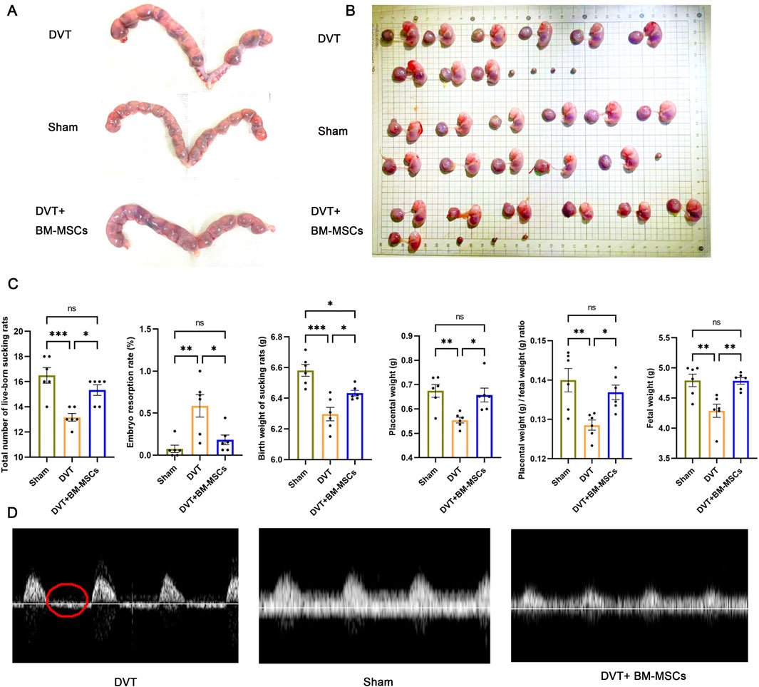 Image consisting of four panels. Panel A shows images of uterine samples from three groups: DVT, Sham, and DVT with BM-MSCs. Panel B displays multiple specimens arranged on a grid, labeled for the three groups. Panel C features five bar graphs showing results for total number of live-born sucklings, embryo resorption rate, birth weight, placental weight, placental to fetal weight ratio, and fetal weight across the groups, with statistical significance indicated. Panel D presents ultrasound waveforms for DVT, Sham, and DVT with BM-MSCs, highlighting differences in flow patterns.