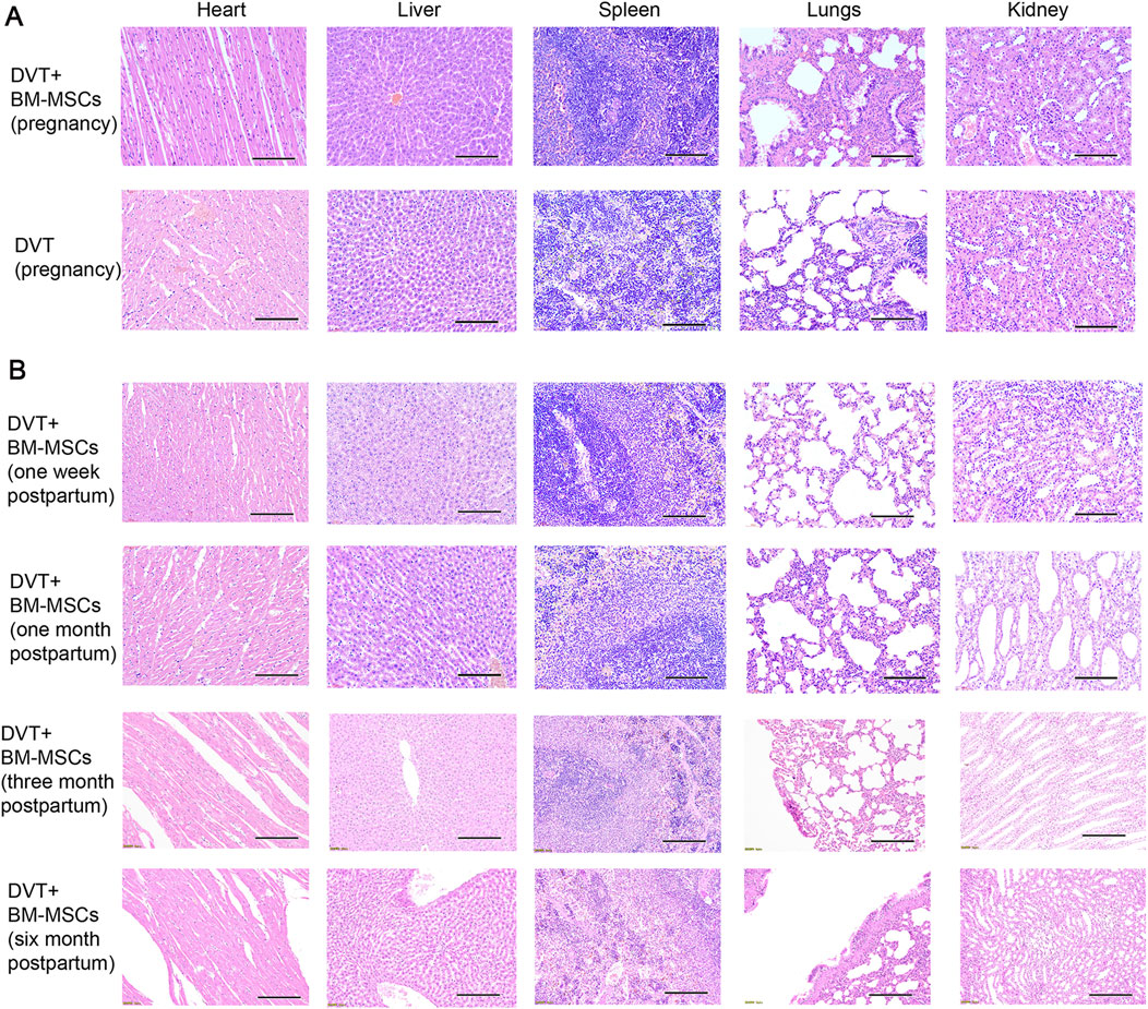 Histological images comparing tissue samples of heart, liver, spleen, lungs, and kidney during pregnancy and postpartum. Panel A shows samples with DVT plus BM-MSCs and DVT alone during pregnancy. Panel B shows postpartum samples with DVT plus BM-MSCs at one week, one month, three months, and six months. Each column represents different organs, and each row represents different conditions and time points.